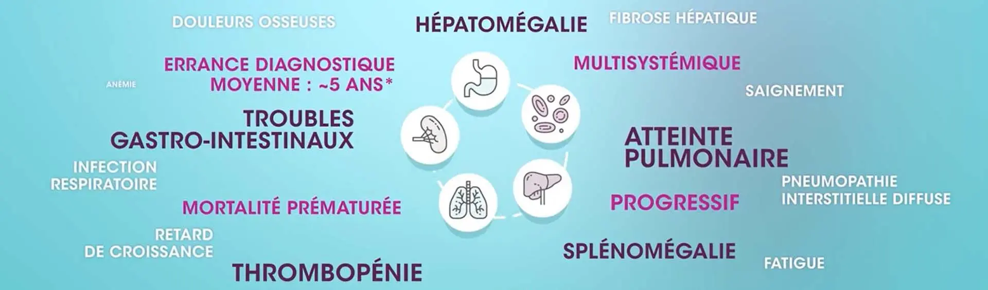 Vidéo : l’ASMD expliqué en 4 minutes