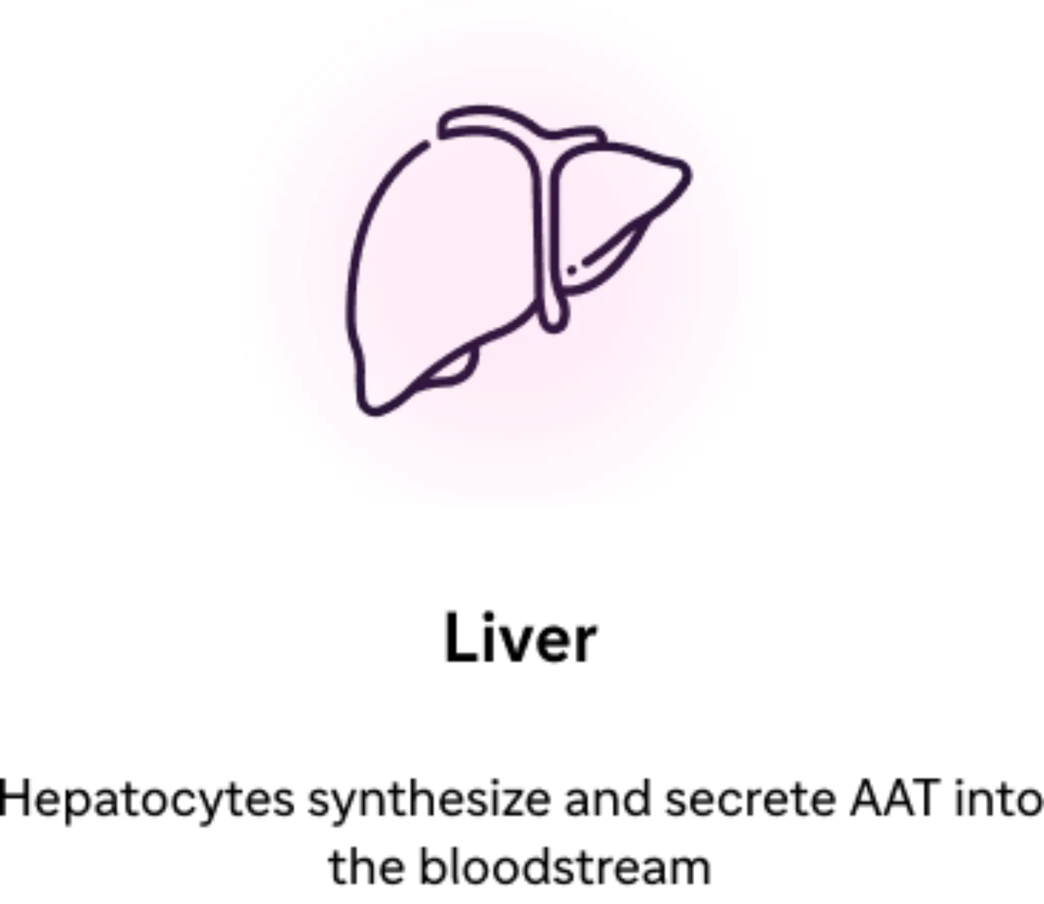 Alpha-1 Antitrypsin Deficiency | Mechanism of Disease