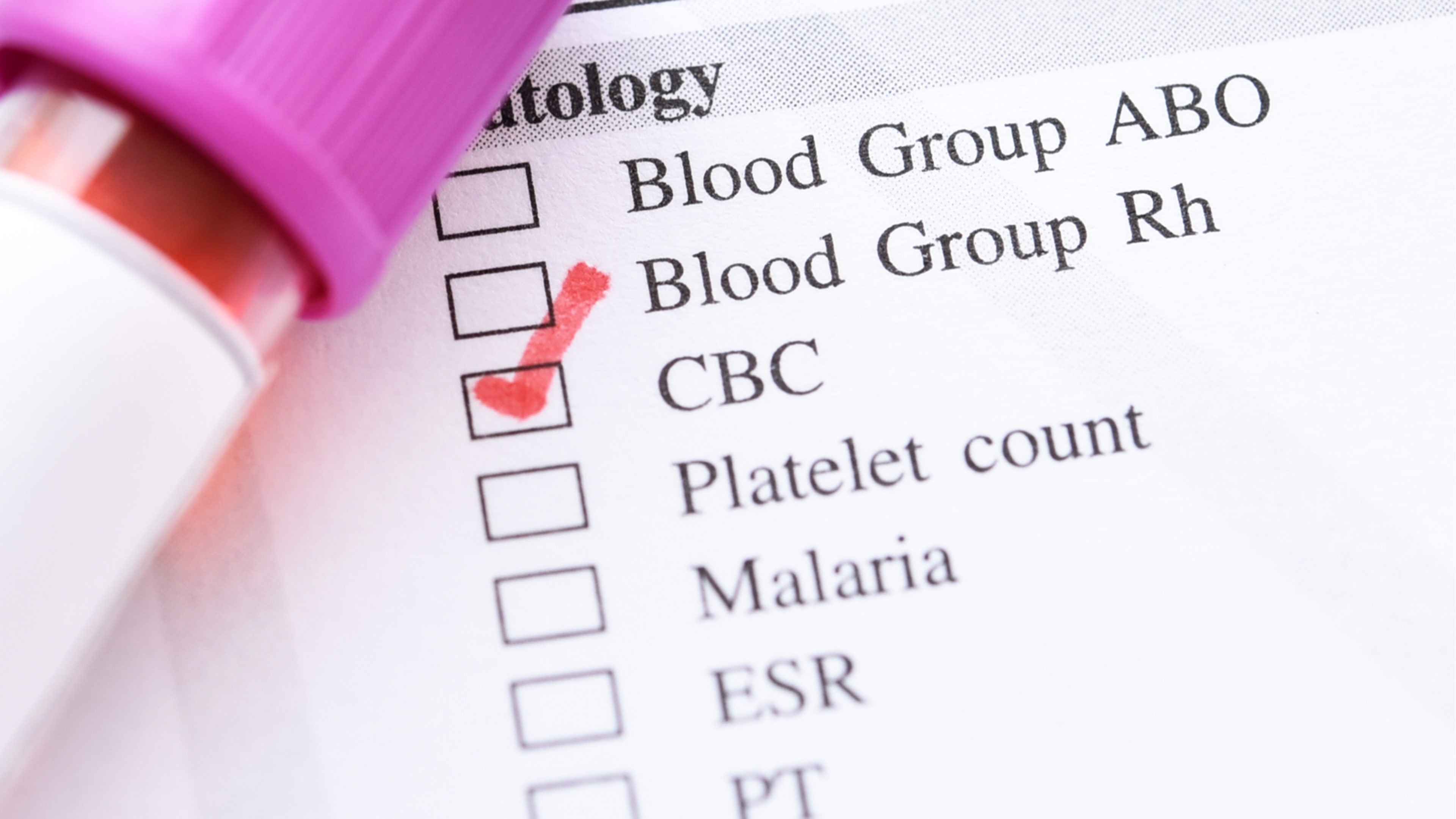 A checklist of pathology where CBC is checked