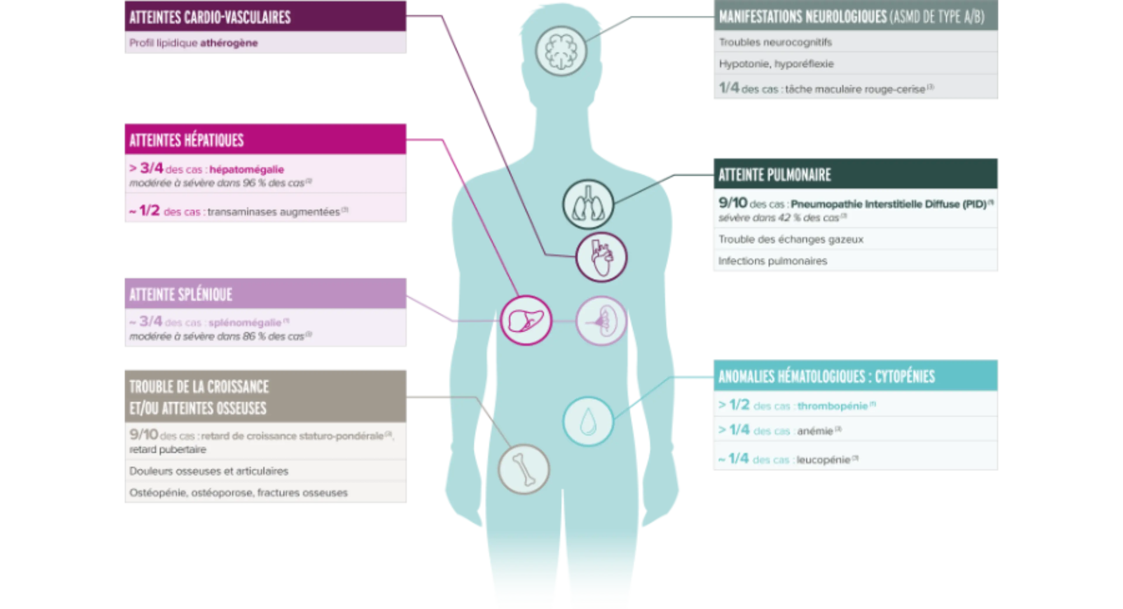 Schéma d’un humanoïde récapitulant les principaux symptômes évocateurs de l’ASMD :  Atteintes neurologiques (types A et A/B),