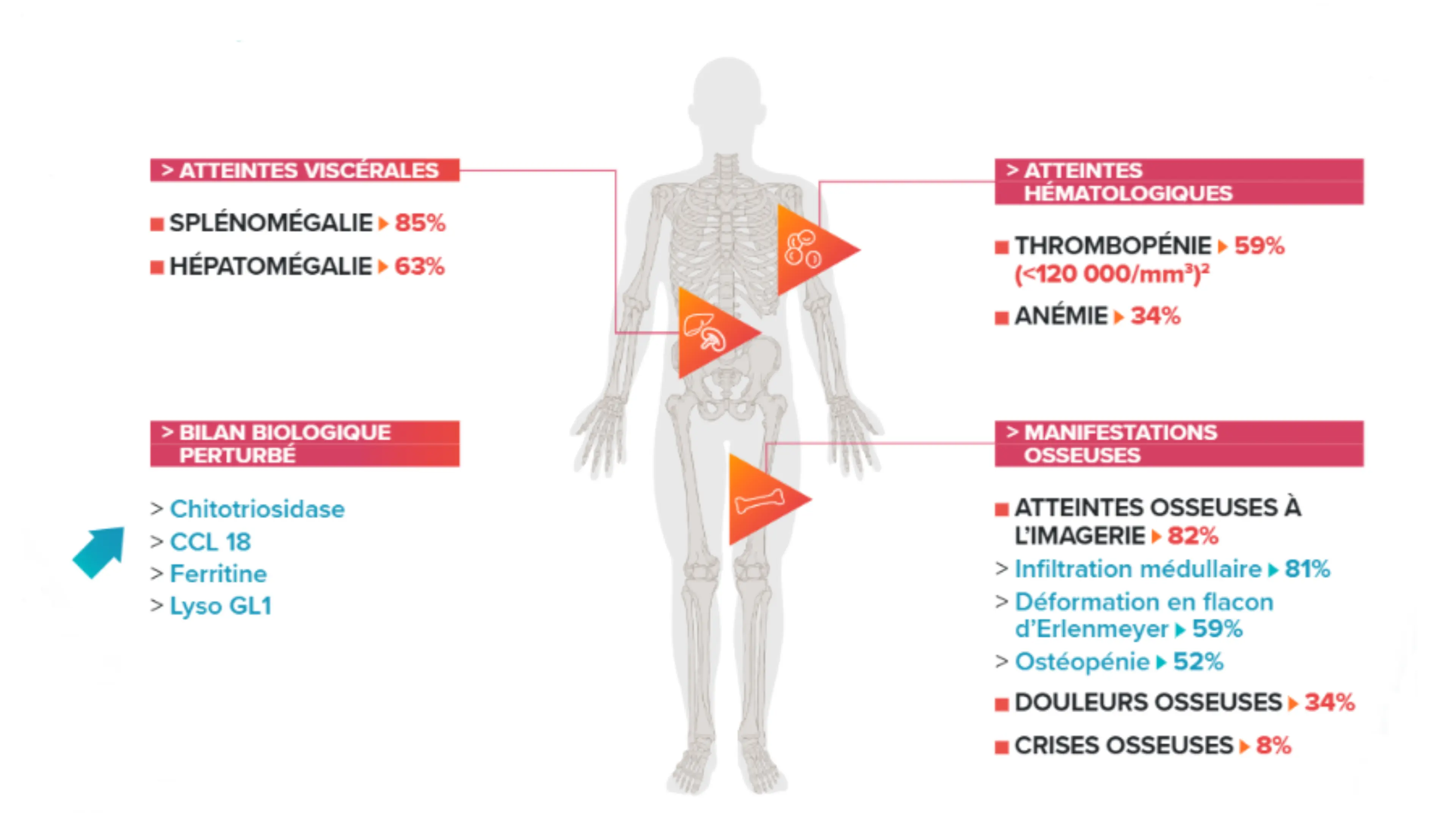 Schéma d’un humanoïde récapitulant les principaux symptômes évocateurs de la maladie de Gaucher :  Splénomégalie, Hépatomégal
