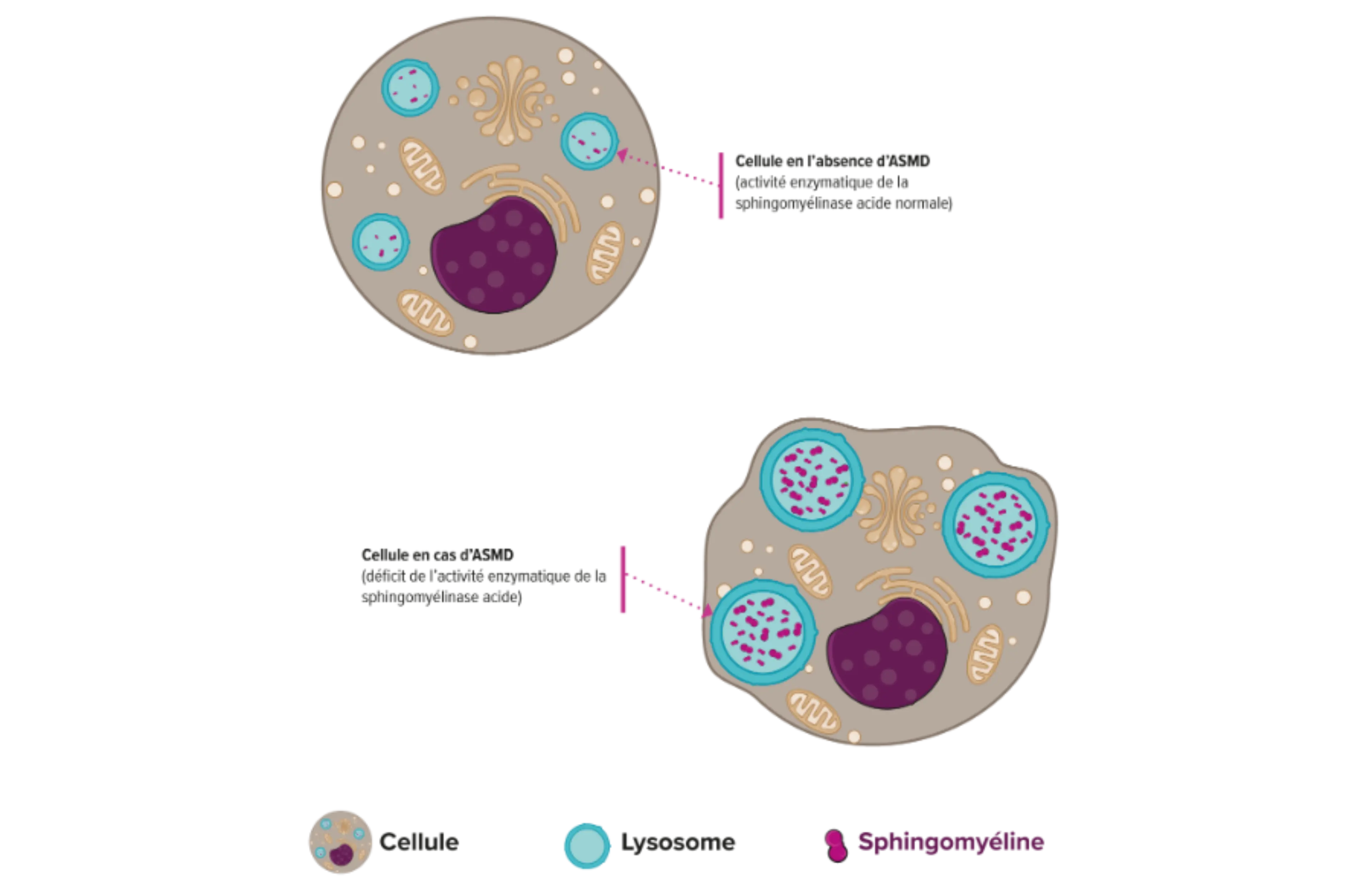 Schéma simplifié du processus de surcharge lysosomale dans l’ASMD :  (à gauche) Cellule en l’absence d’ASMD (activité enzymat