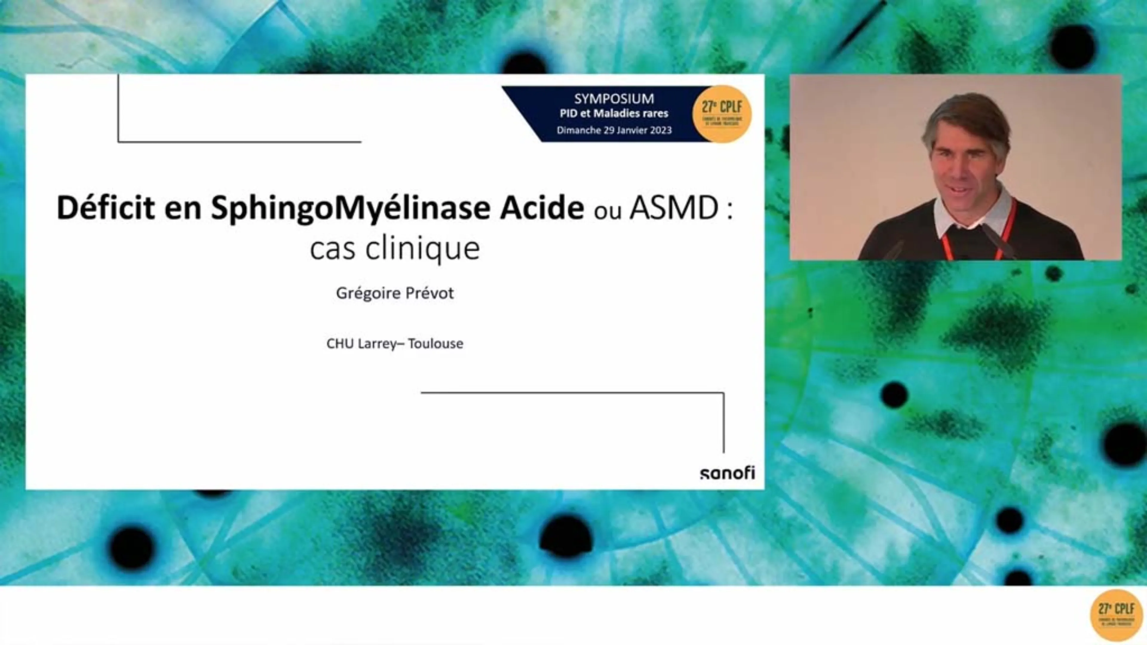Miniature d'article - Cas clinique : Déficit en SphingoMyélinase Acide ou ASMD