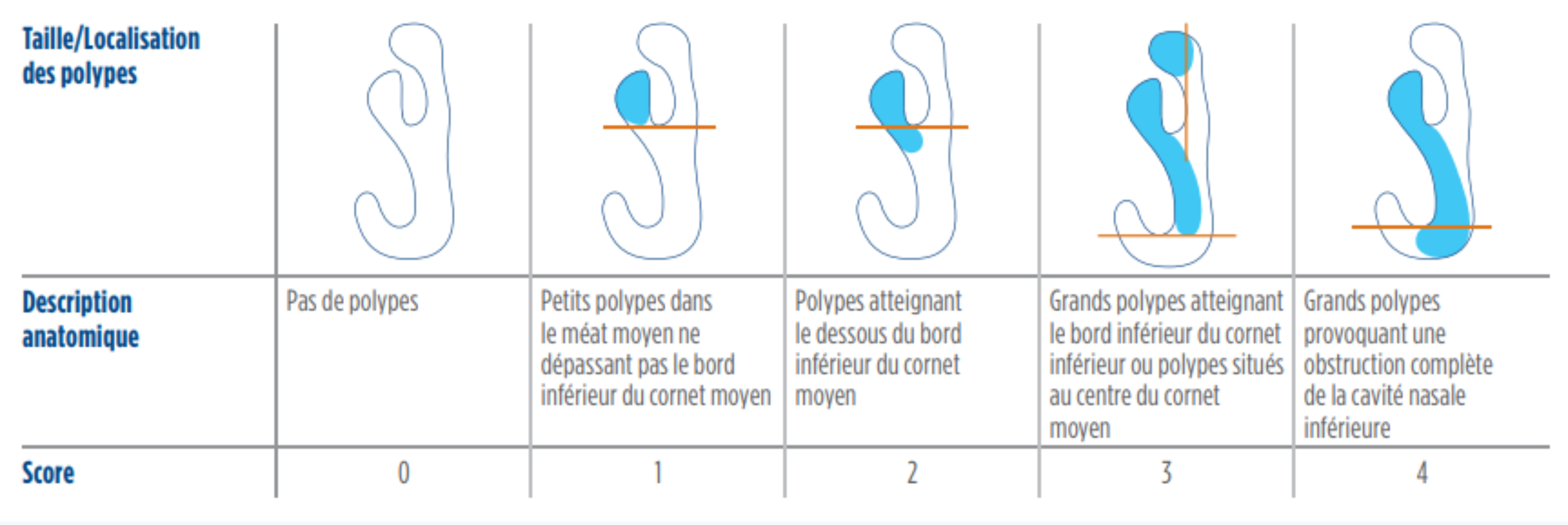 Tableau et descriptions des types de polypes avec scores