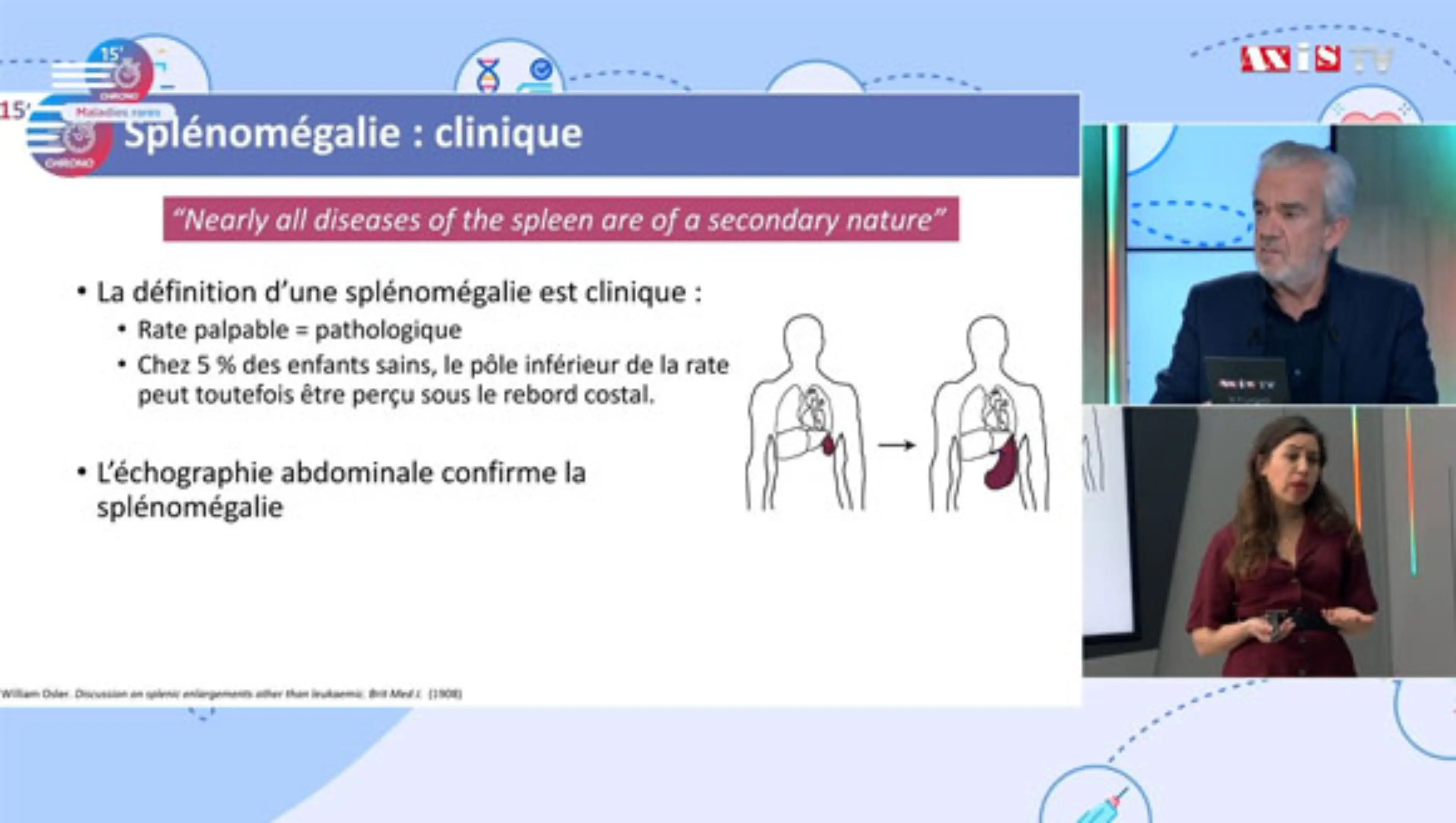 Splénomégalie clinique