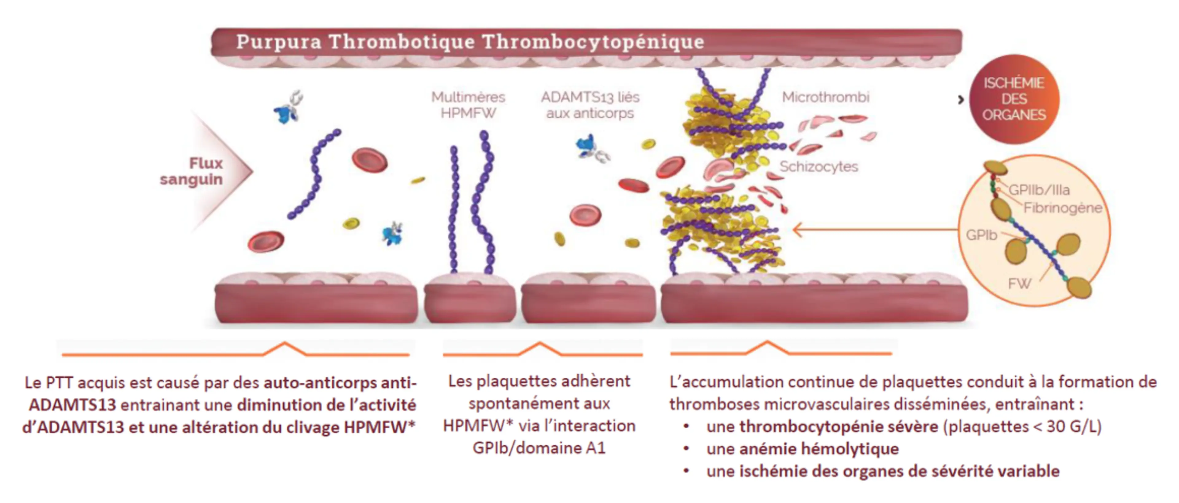 Microangiopathie Thrombotique Physiopathologie Du PTT Microangiopathie Thrombotique Physiopathologie Du PTT