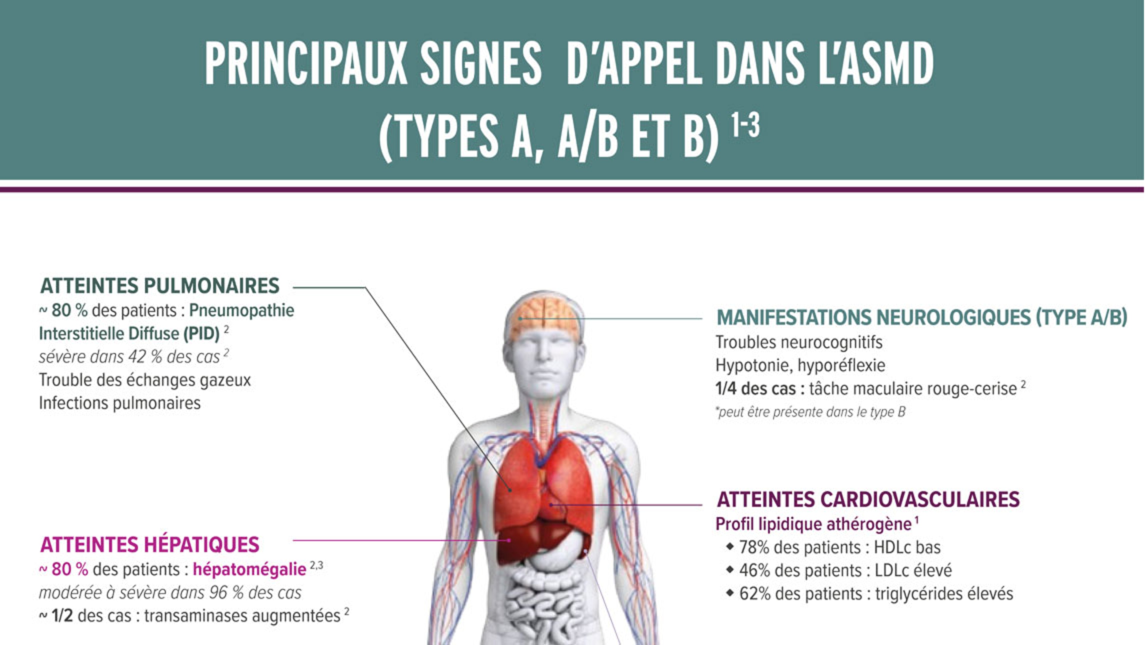 Principaux signes d'appel dans l'ASMD.