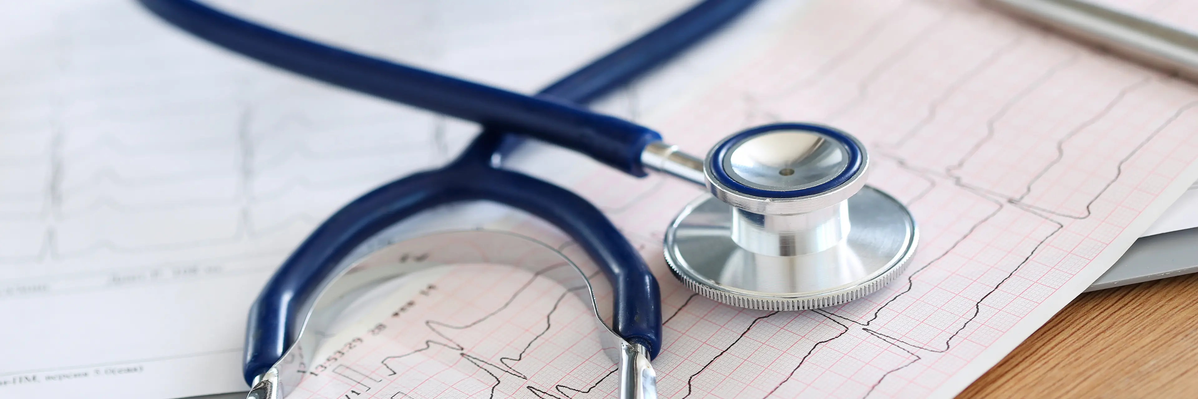 Stethoskop liegt auf einem EKG-Ausdruck mit Herzfrequenzkurven