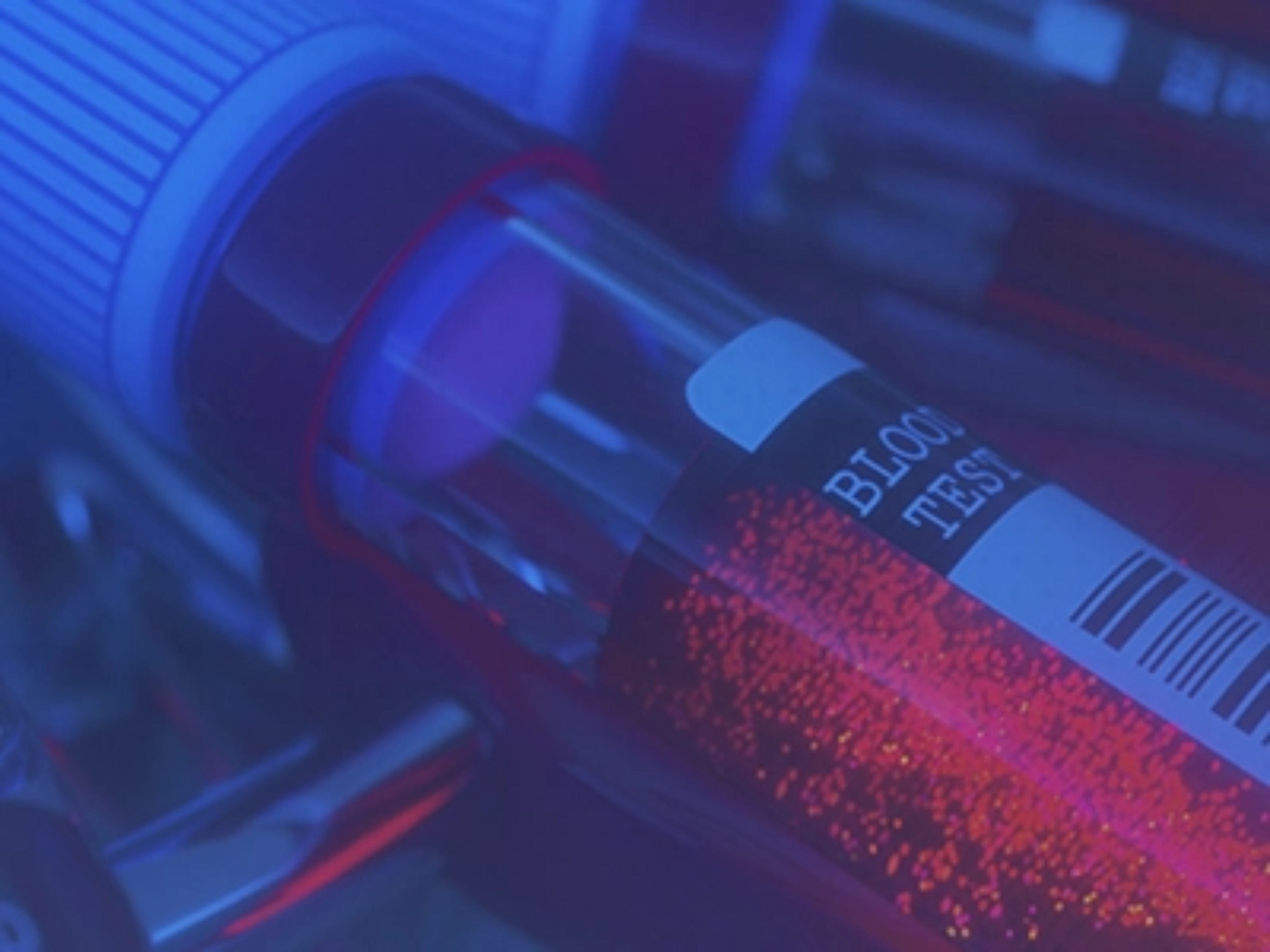 Das Bild zeigt Bluttests, die die Leberwerte bestimmen, anhand derer Morbus Gaucher diagnostiziert werden kann