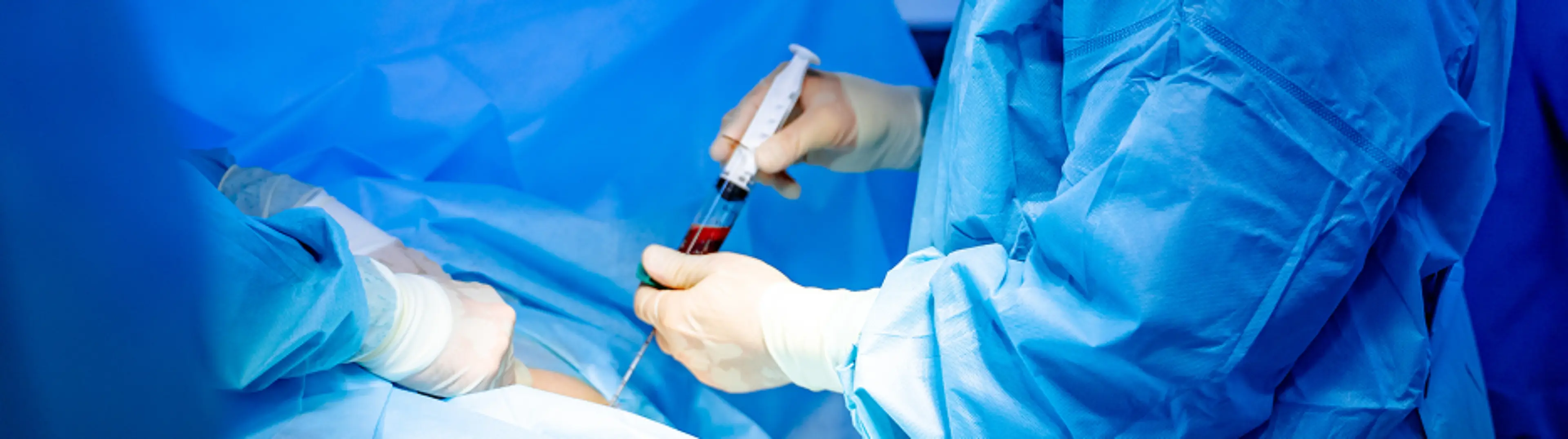 Entnahme einer Knochenmarkprobe beim Multiplen Myelom im Rahmen von Hochrisiko-Zytogenetik