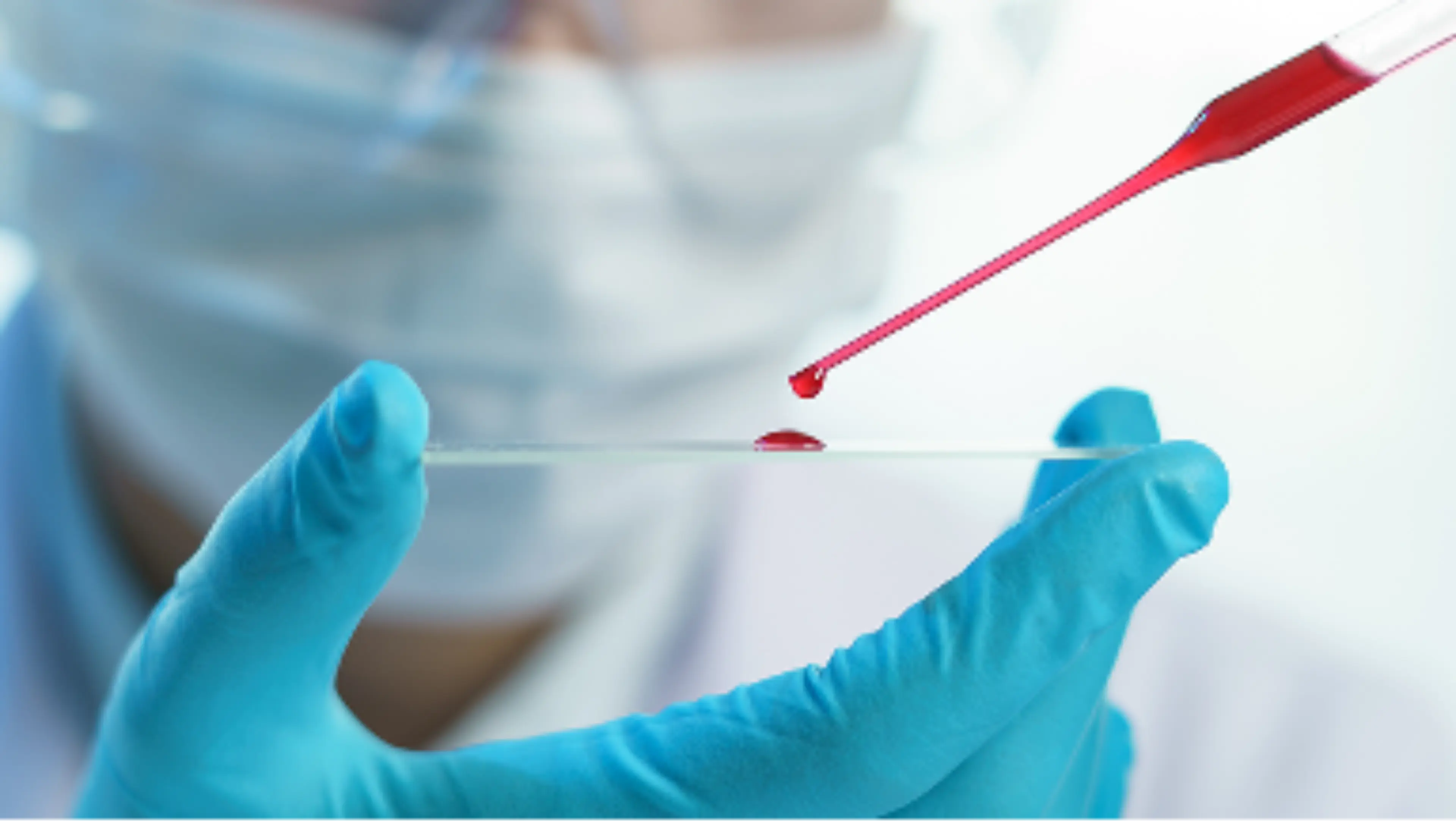 Laborkraft überträgt Blutprobe zur Bestimmung der Blutwerte auf einen Objektträger