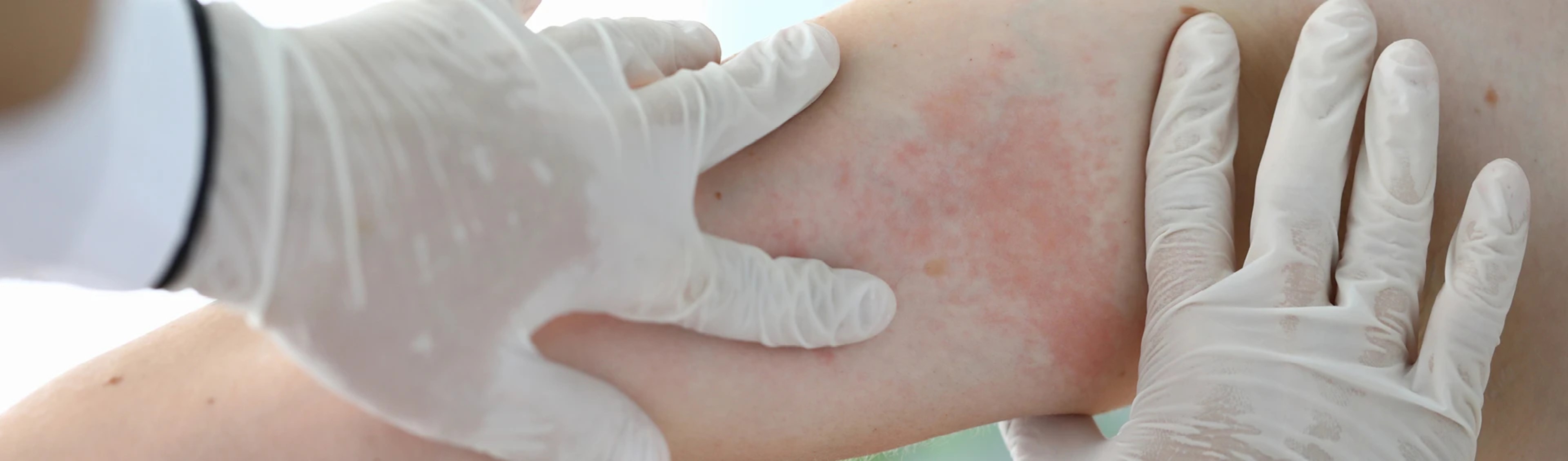 PSA_DDI_23001_Bilder_Sanofi_Campus_Header_Dermatologie_Desktop_1920x565px_V1