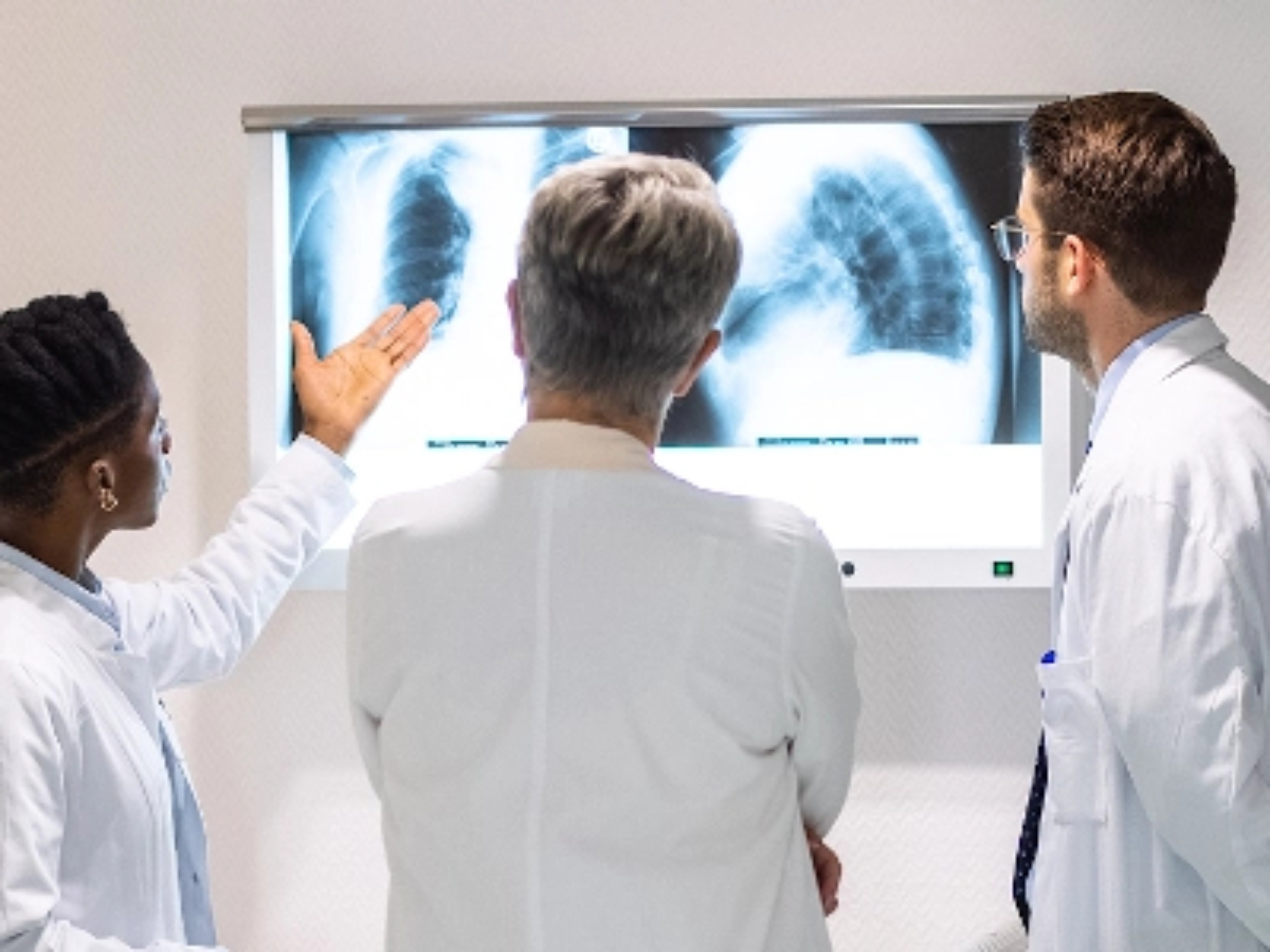 Foto einer Ärzte-Gruppe im Gespräch als Symbol für Morbus Gaucher Kliniken