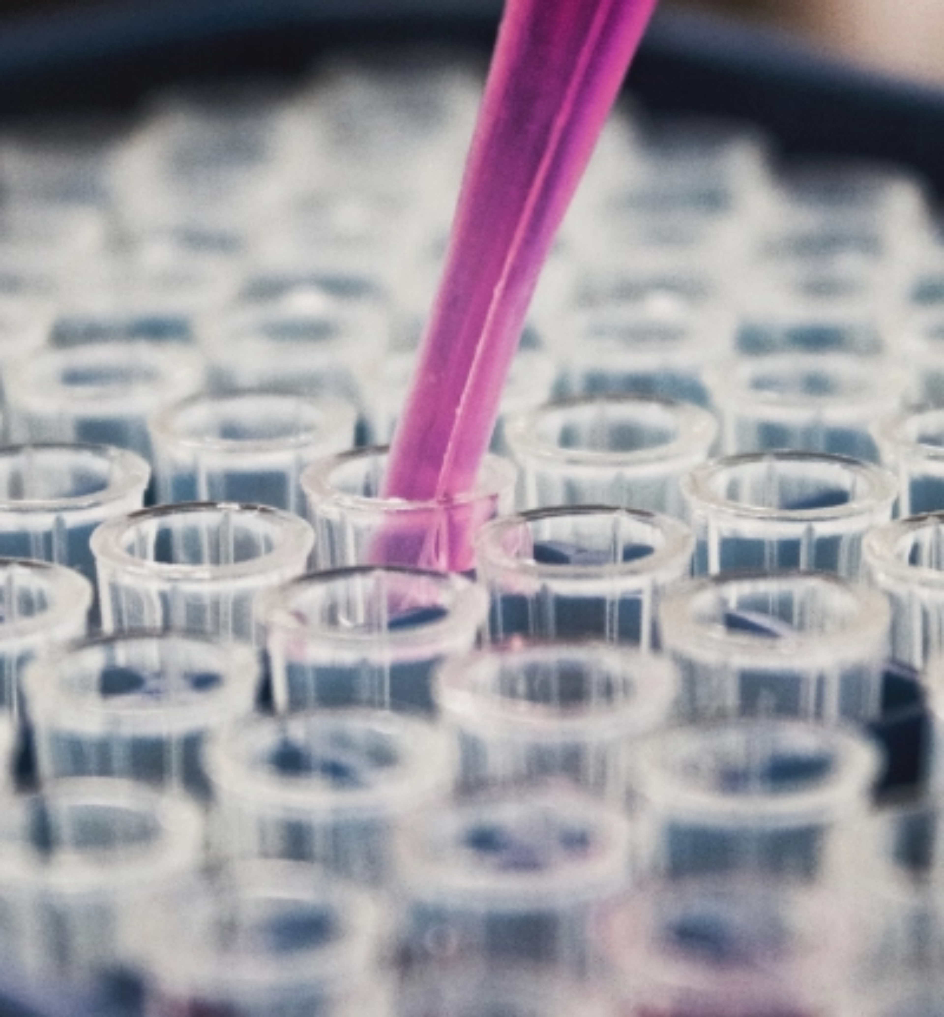 Reagenzgläser und gefüllte Pipette für die Untersuchung von Lysosomalen Speicherkrankheiten
