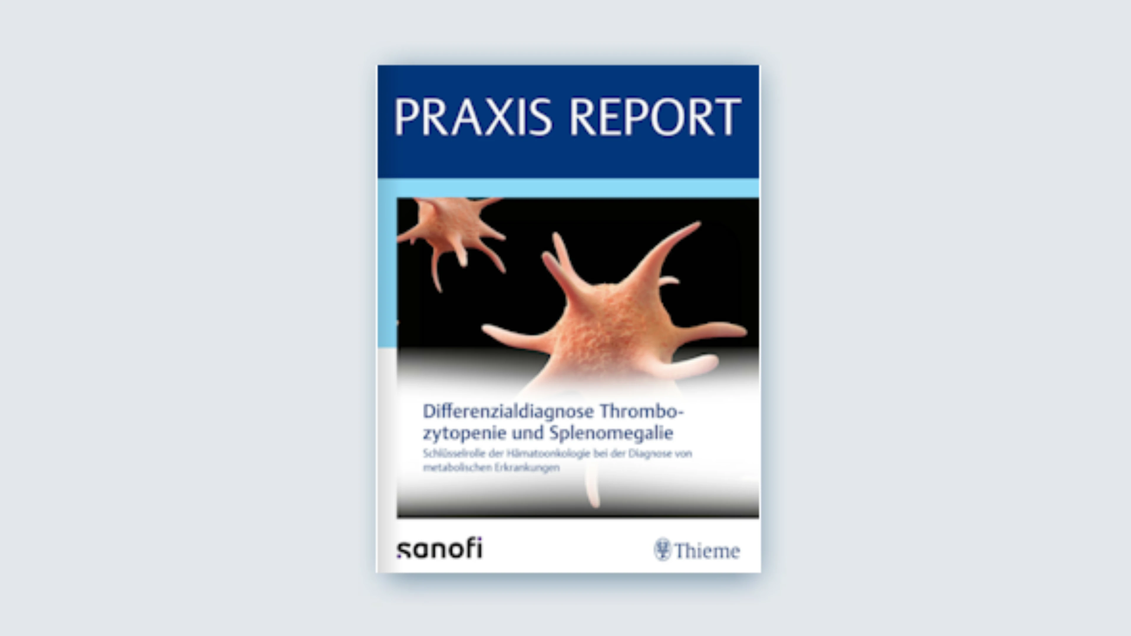 Thieme Praxis Report - Differenzialdiagnose Thrombozytopenie und Splenomegalie
