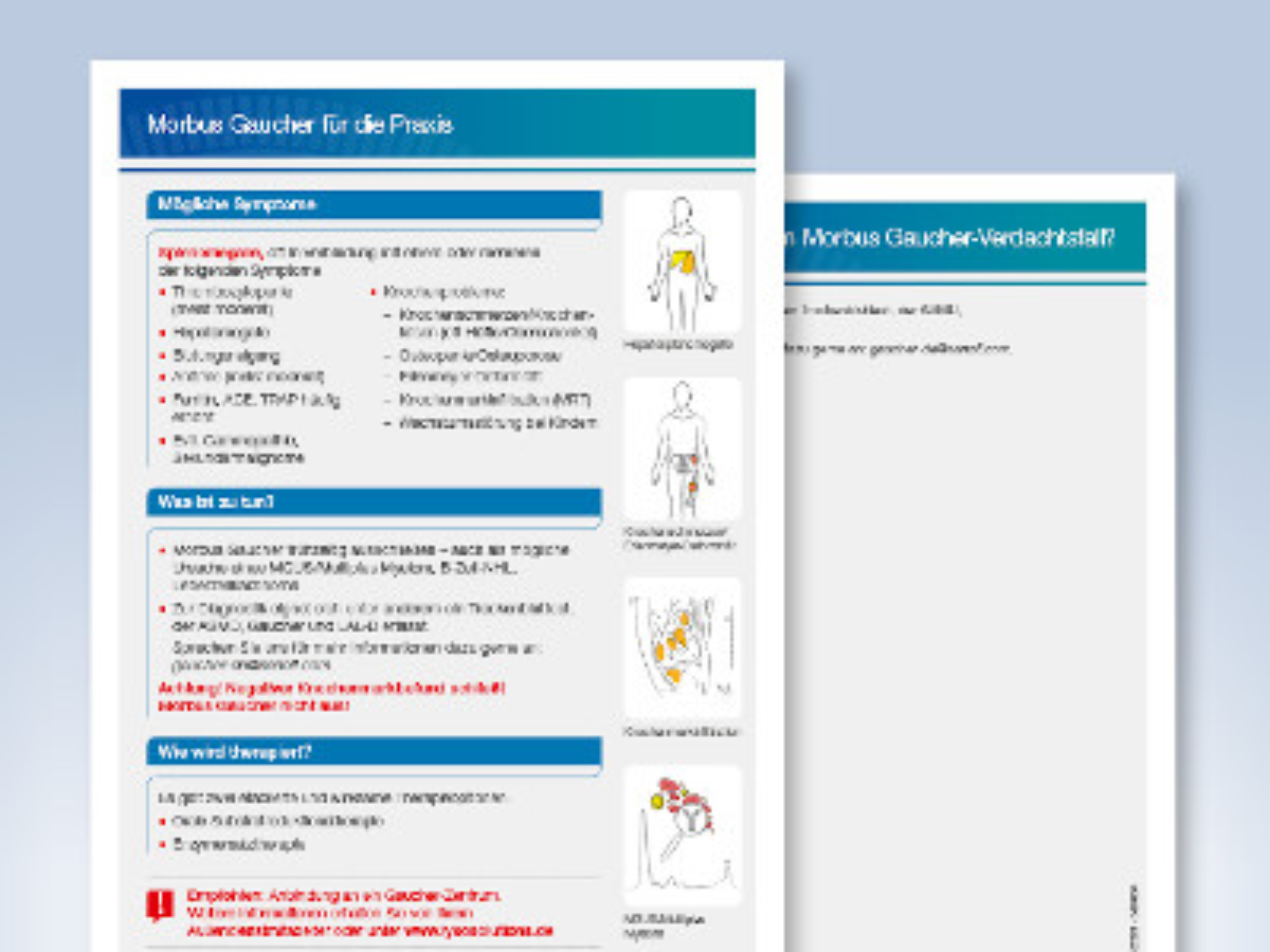 Vorschaubild Diagnosekarte Morbus Gaucher für Pädiater
