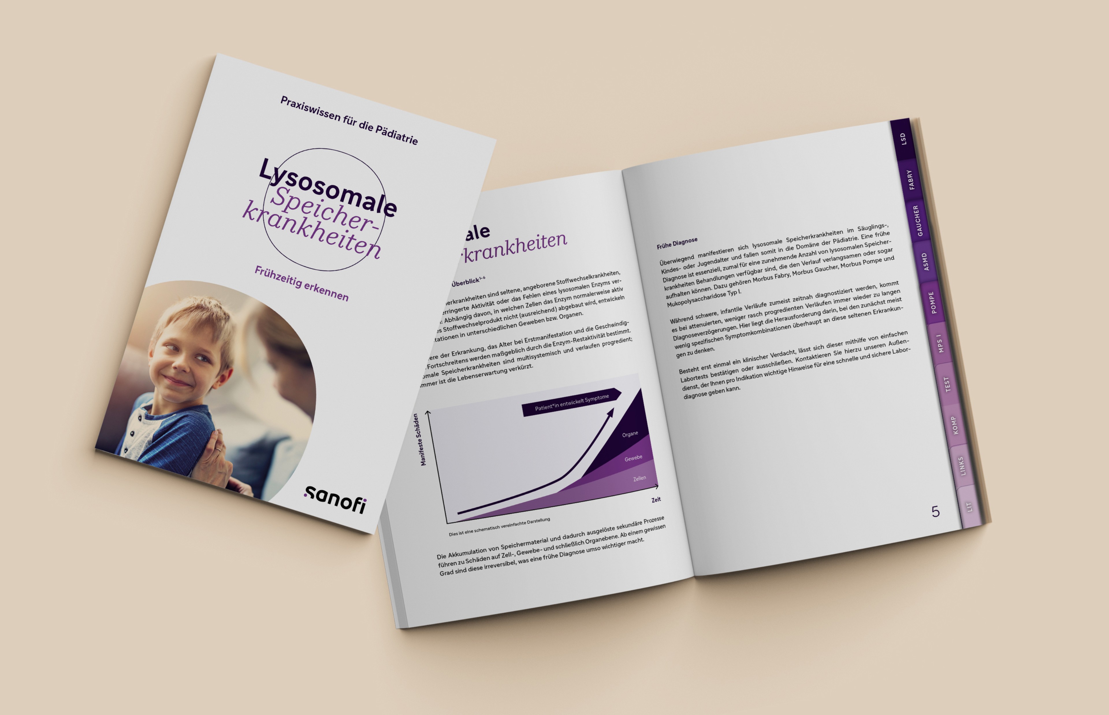 Vorschaubilder und Innenansichten der Broschüre mit Informationen zu lysosomalen Speicherkrankheiten für Pädiater