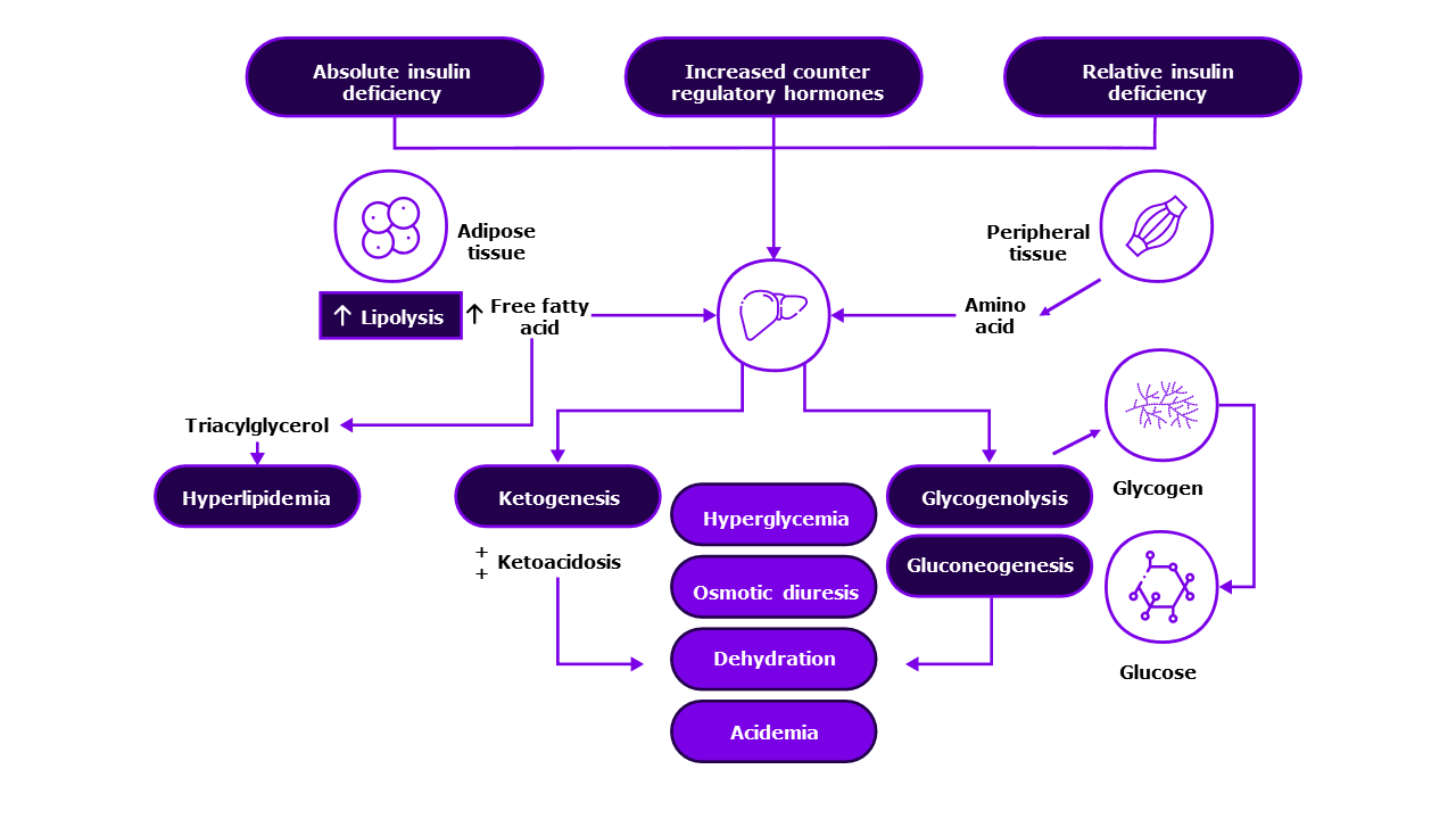 Pathogenesis of DKA