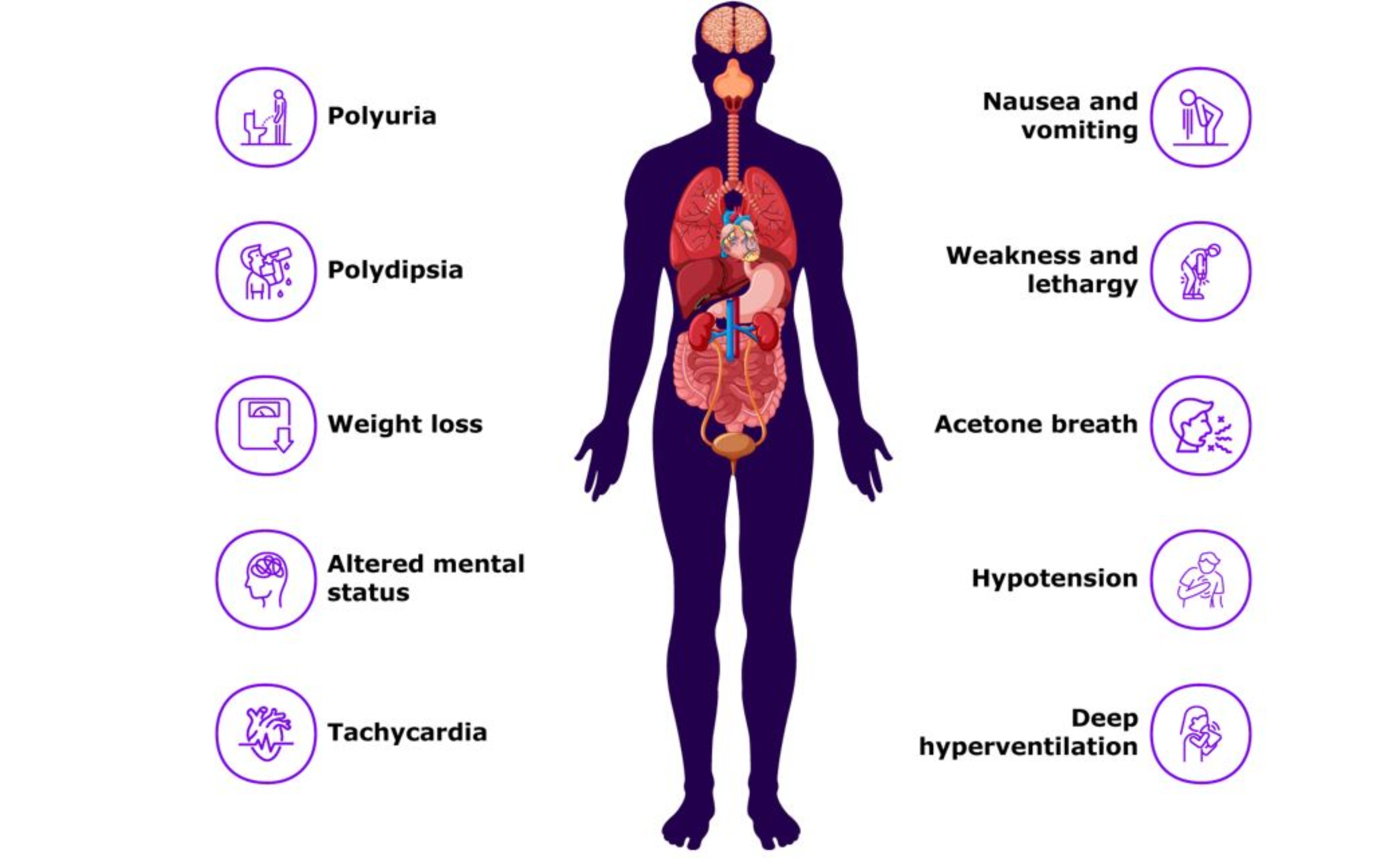 Symptoms of DKA