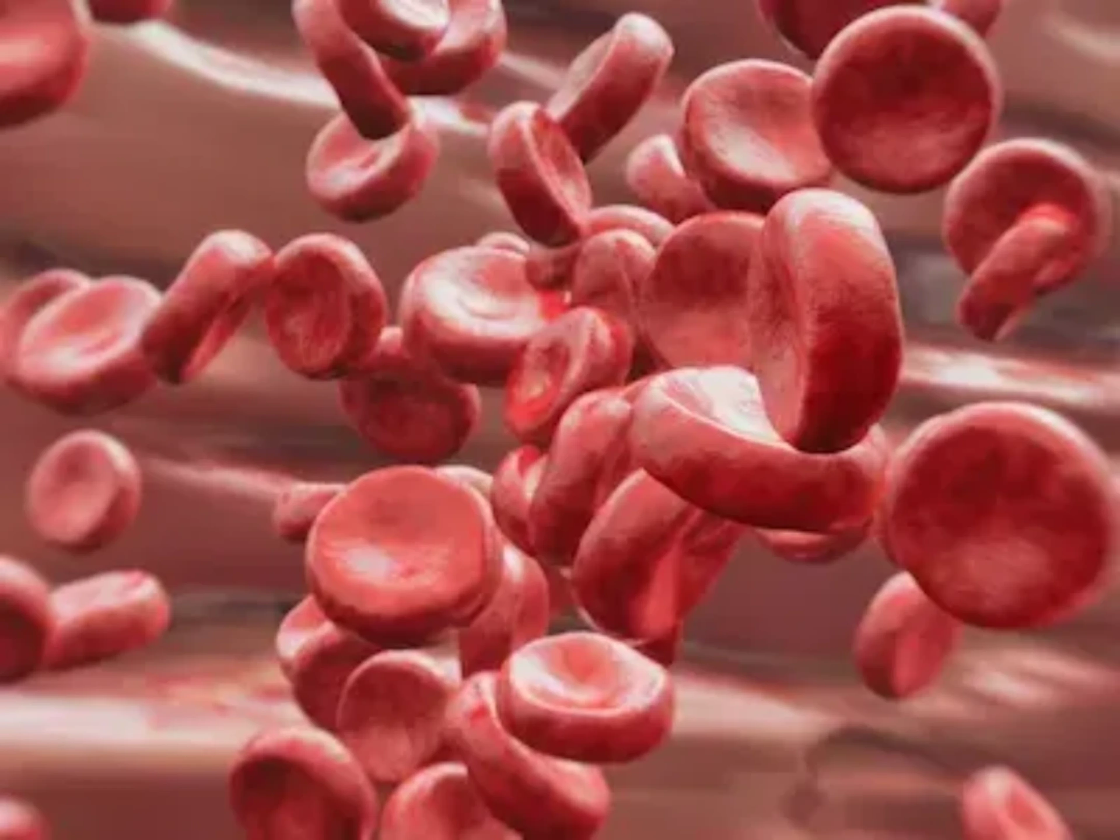  Recurrence of VTE in Patients with Recent Gestational DVT or PE
