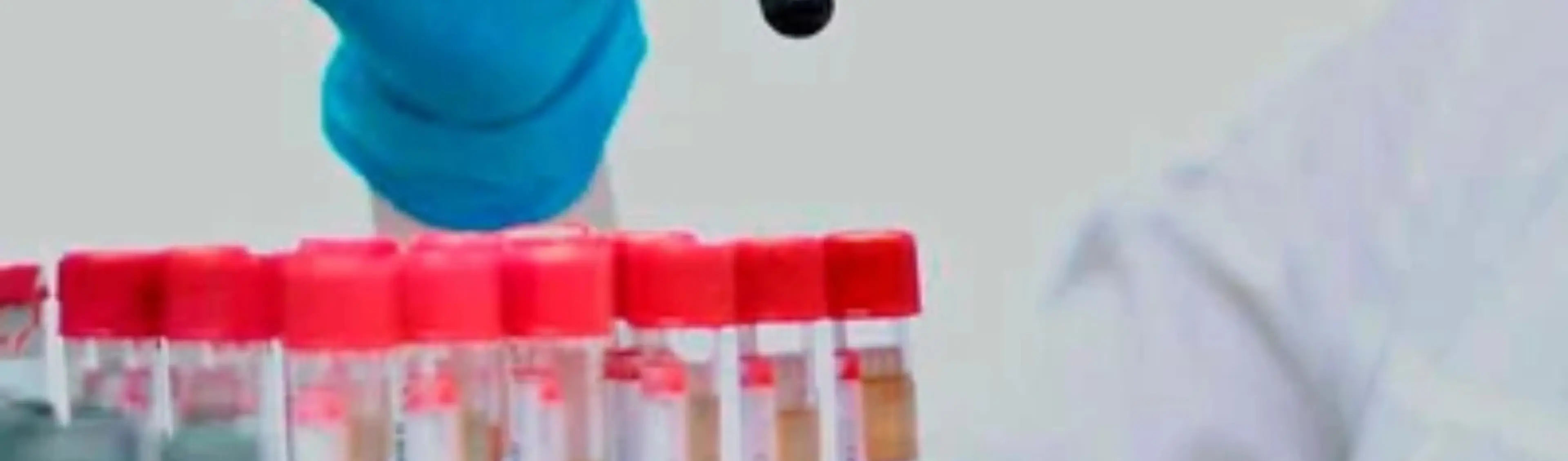 diagnostic-gaucher-header-image