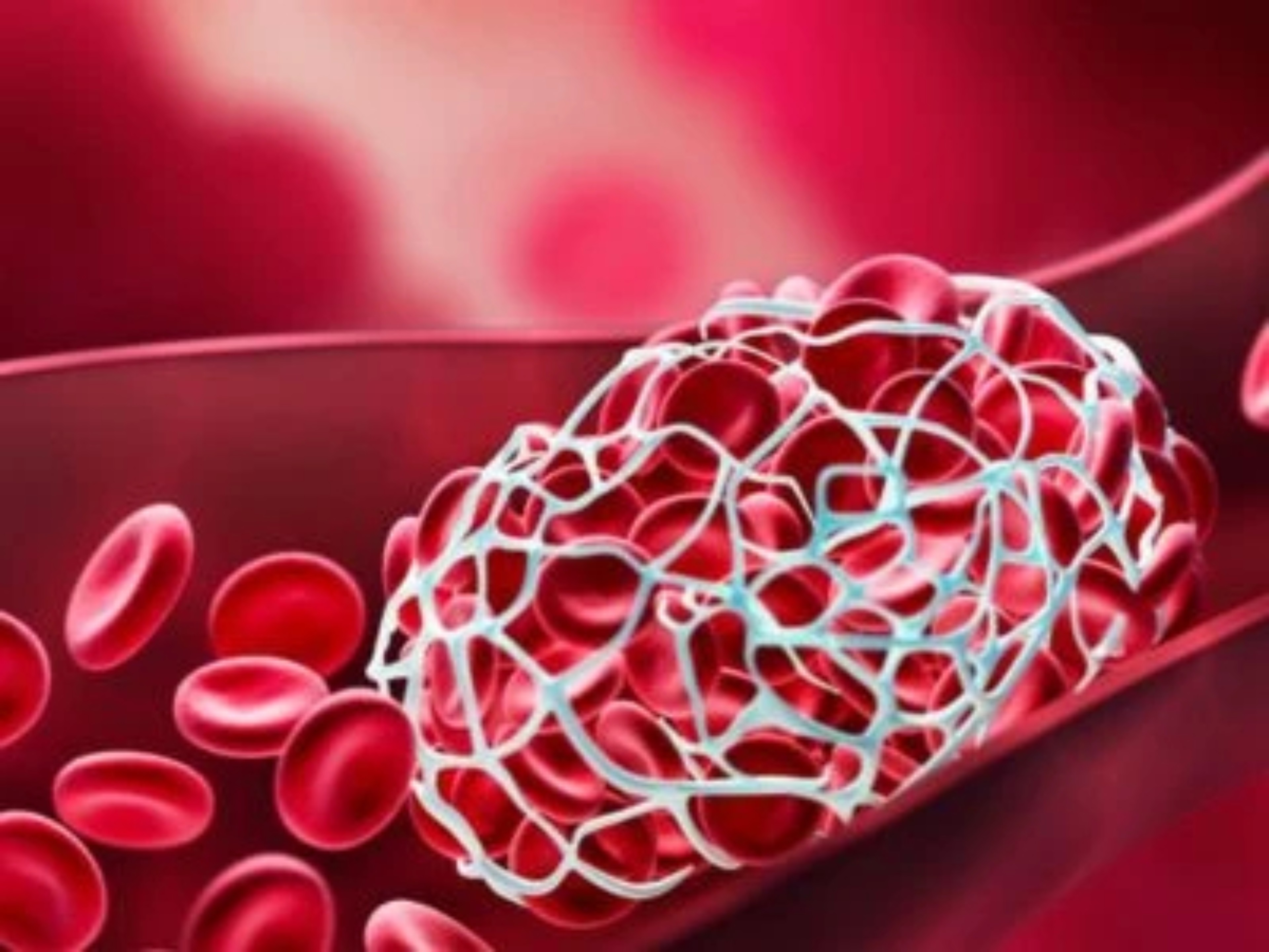 conexion-obesidad-trombosis-th