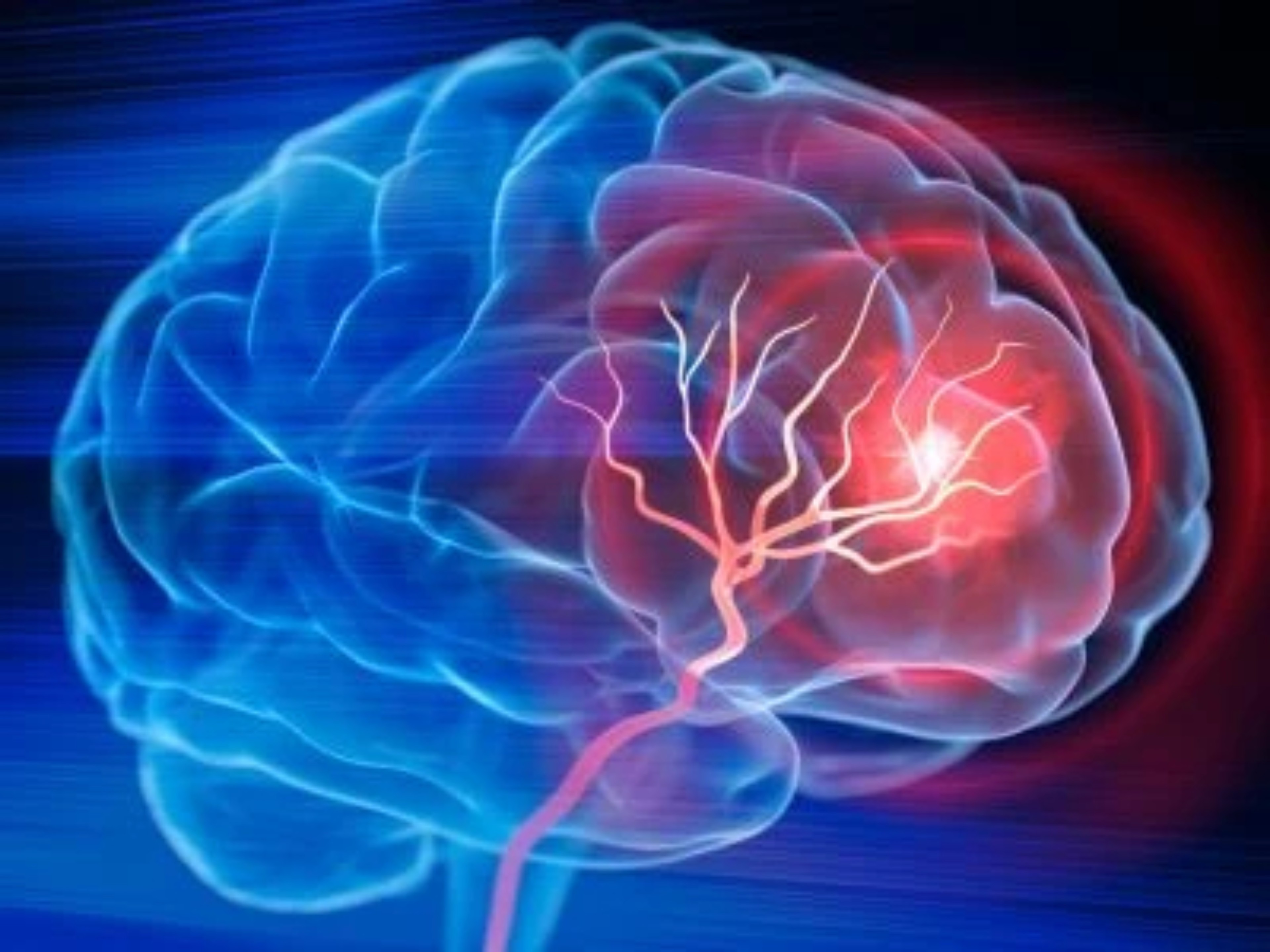cc-dislipemia-ipcsk9-neurologia-thumbnail