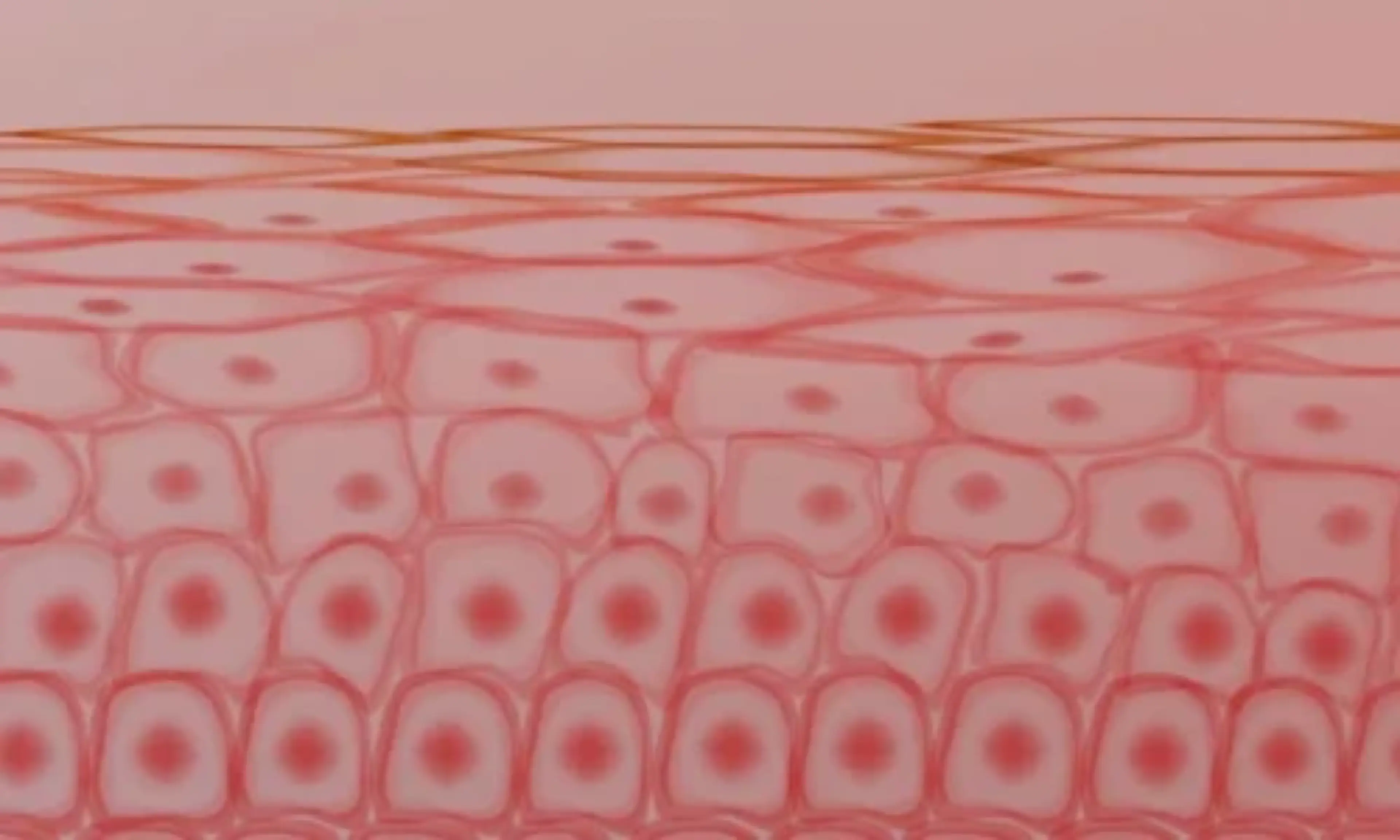 Definición dermatitis atópica