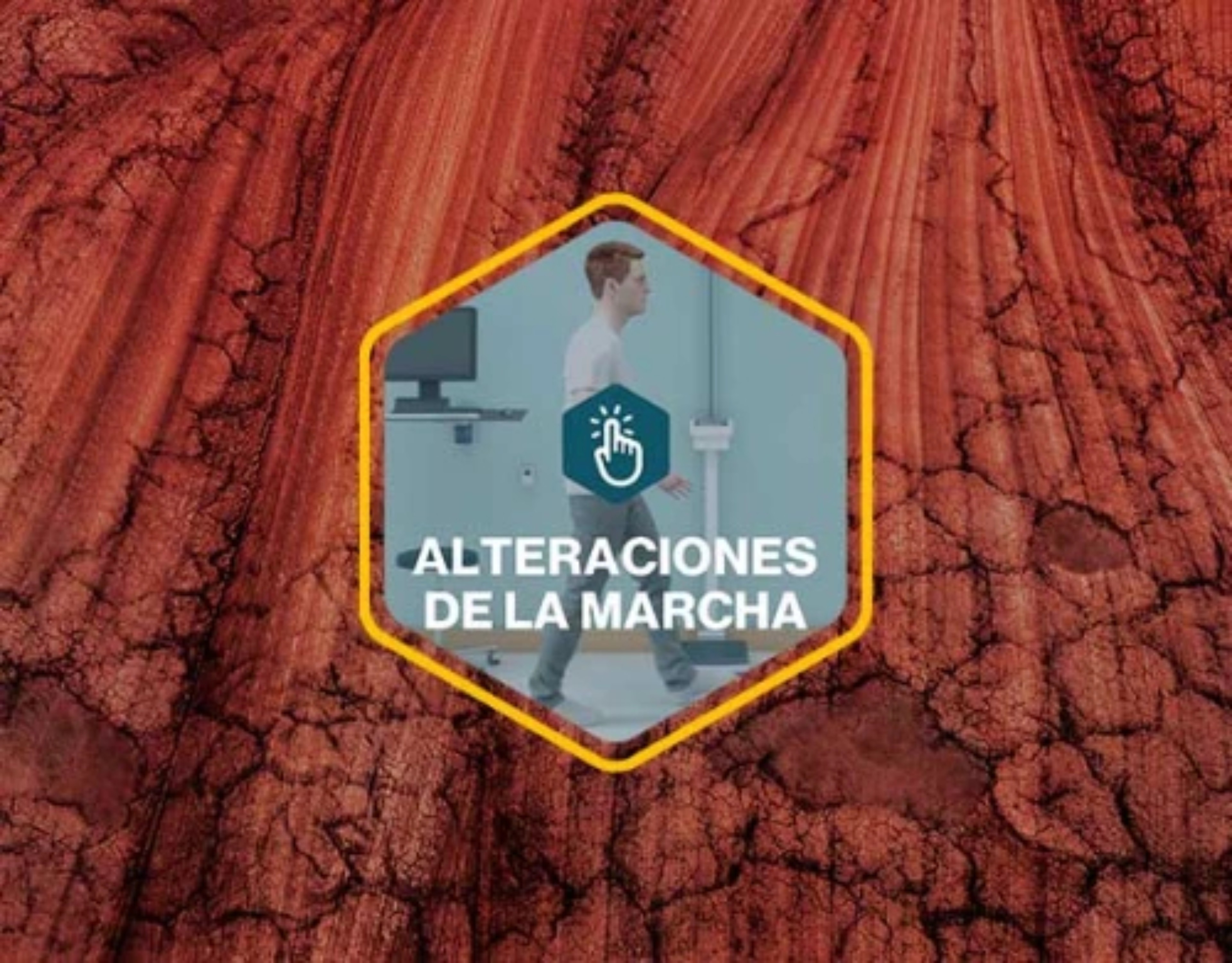 alteraciones-marcha-card