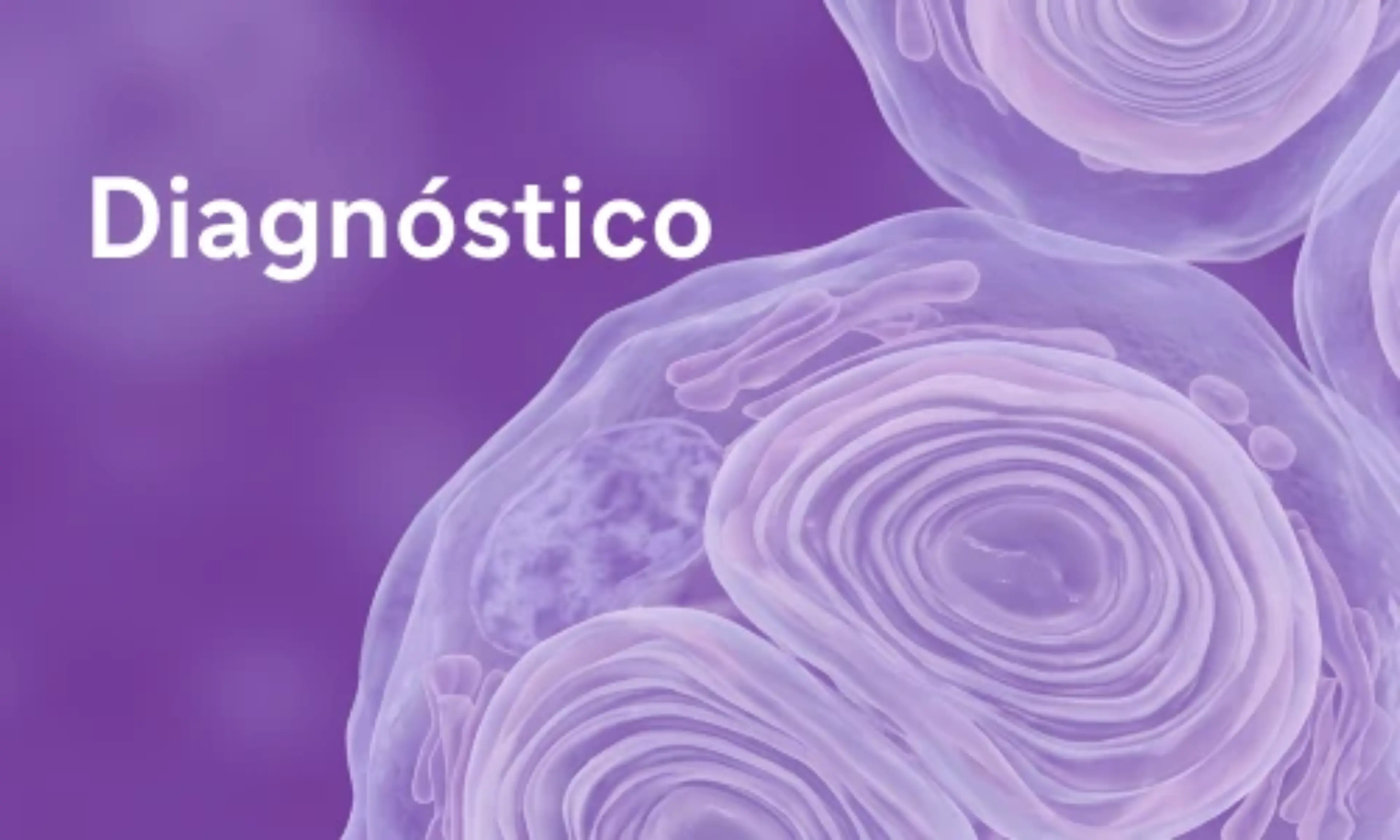 Diagnóstico enfermedad de Fabry