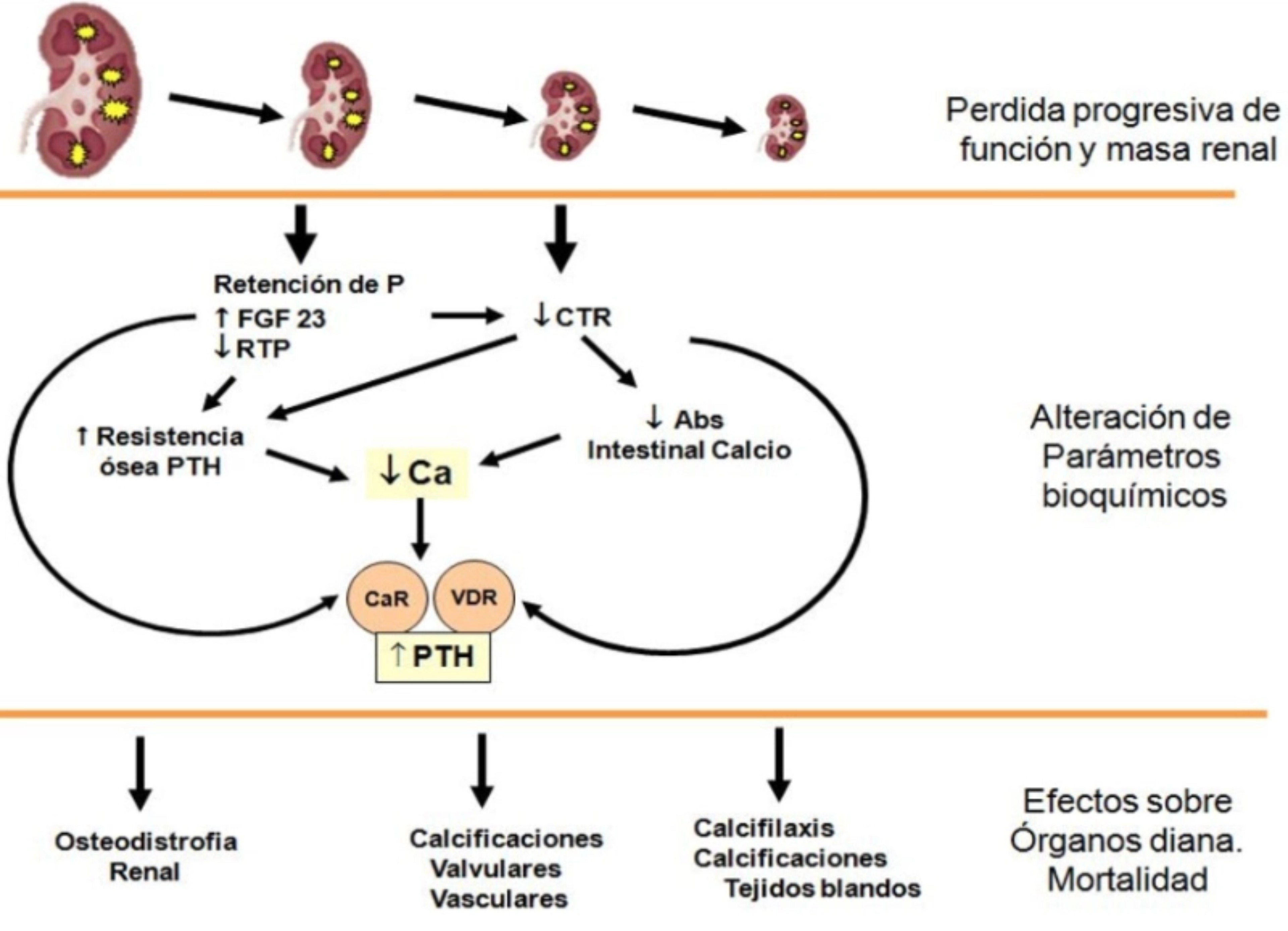 Alteraciones de los parámetros bioquímicos en la progresión de la enfermedad renal crónica (ERC)