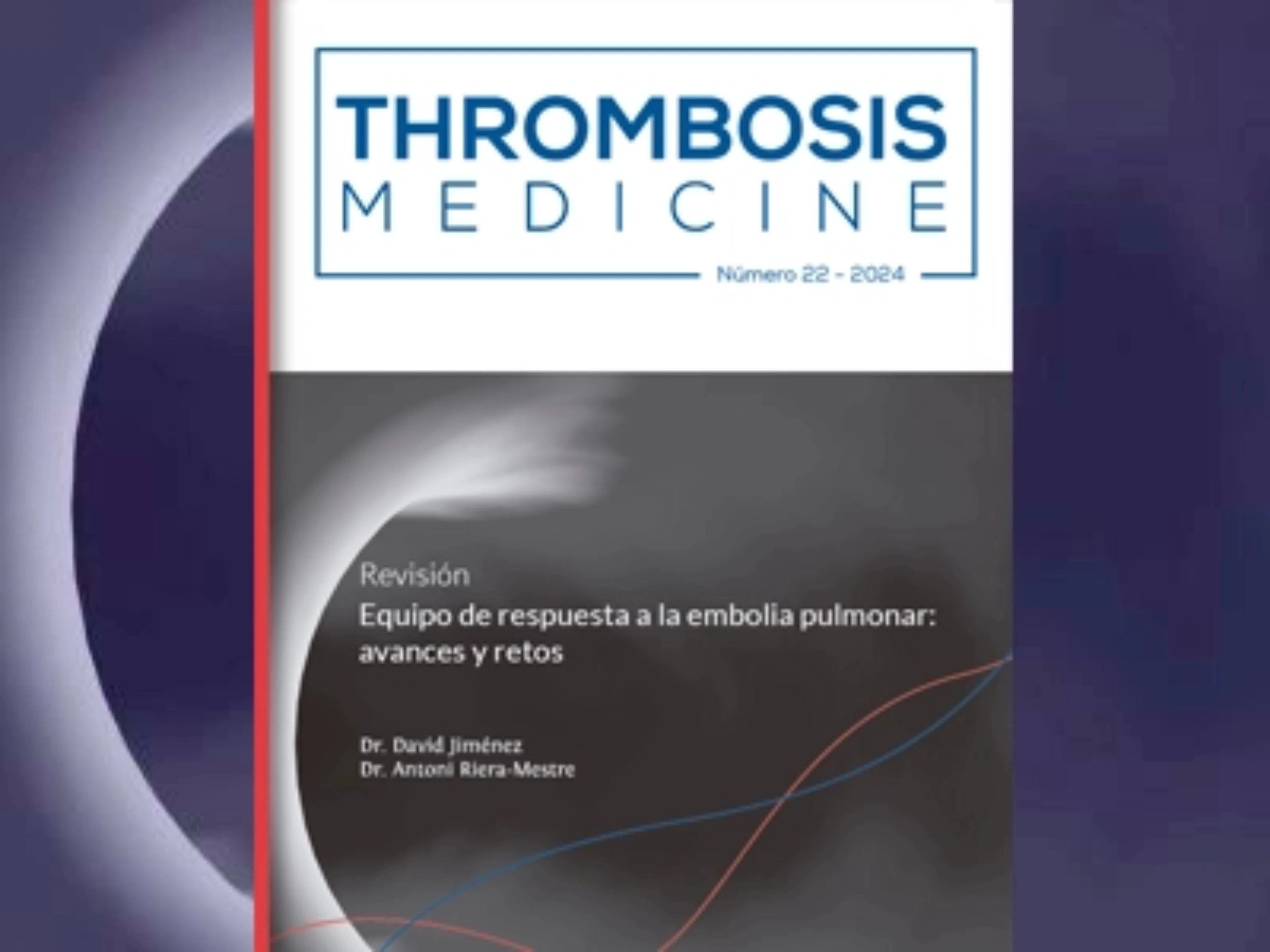 equipo-respuesta-embolia-pulmonar-avances-retos-th