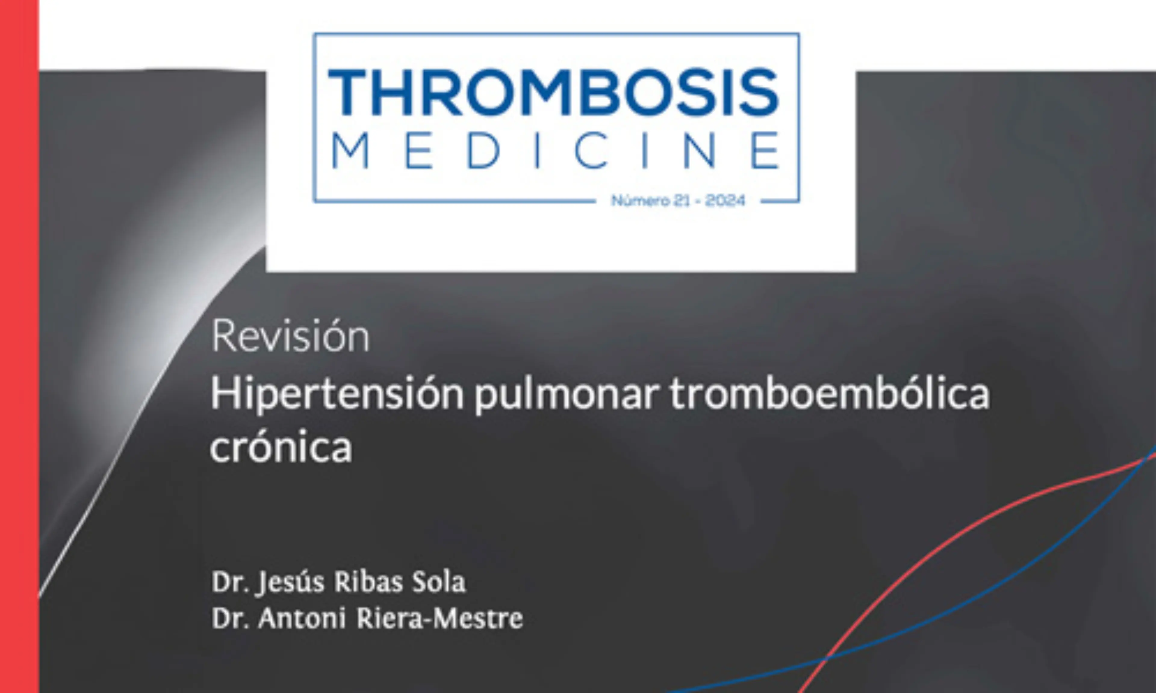 Revisión: Hipertensión pulmonar tromboembólica crónica