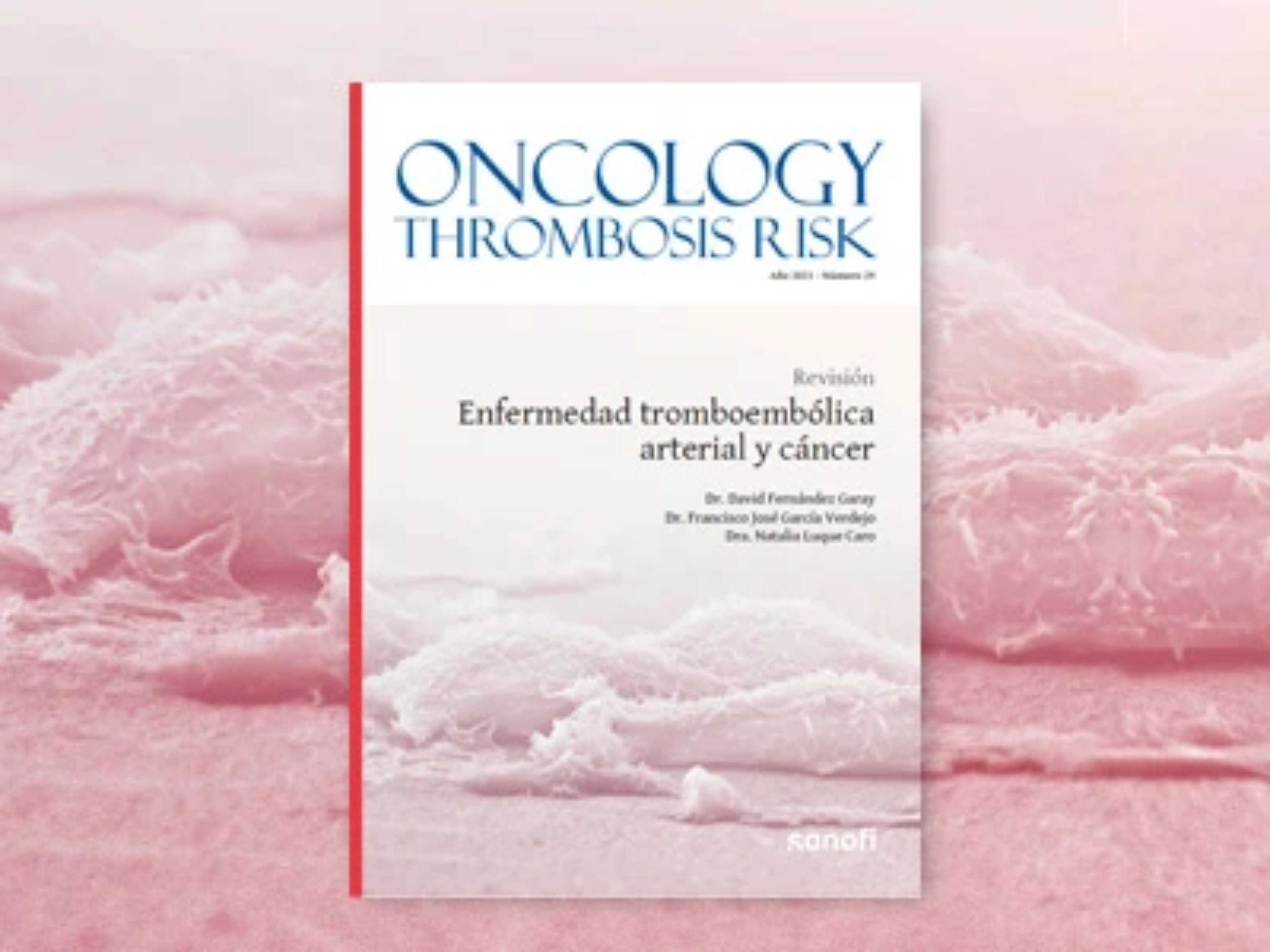 enfermedad-tromboembolica-arterial-cancer-thumbnai