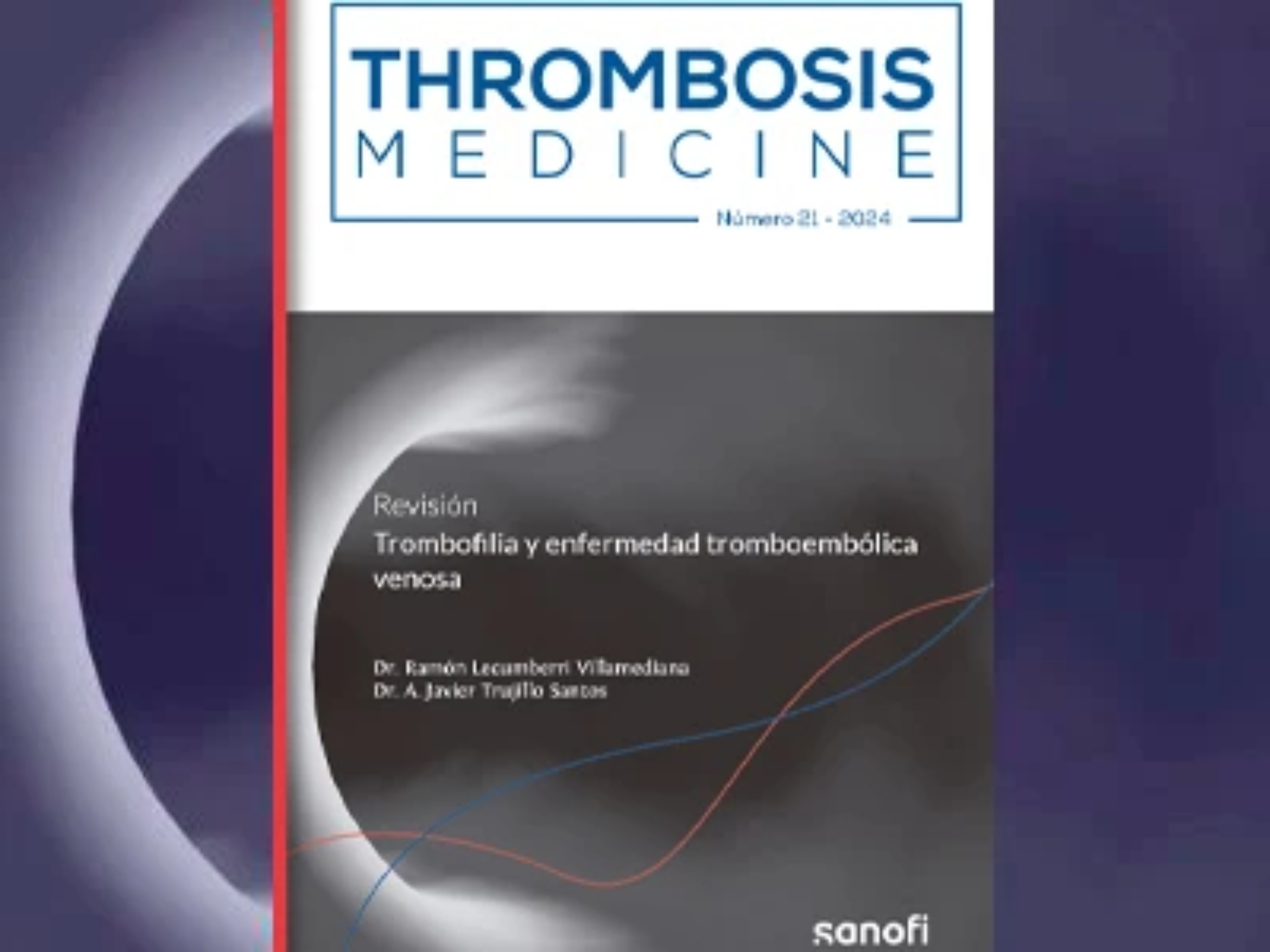 trombofilia-y-enfermedad-tromboembolica-venosa-th
