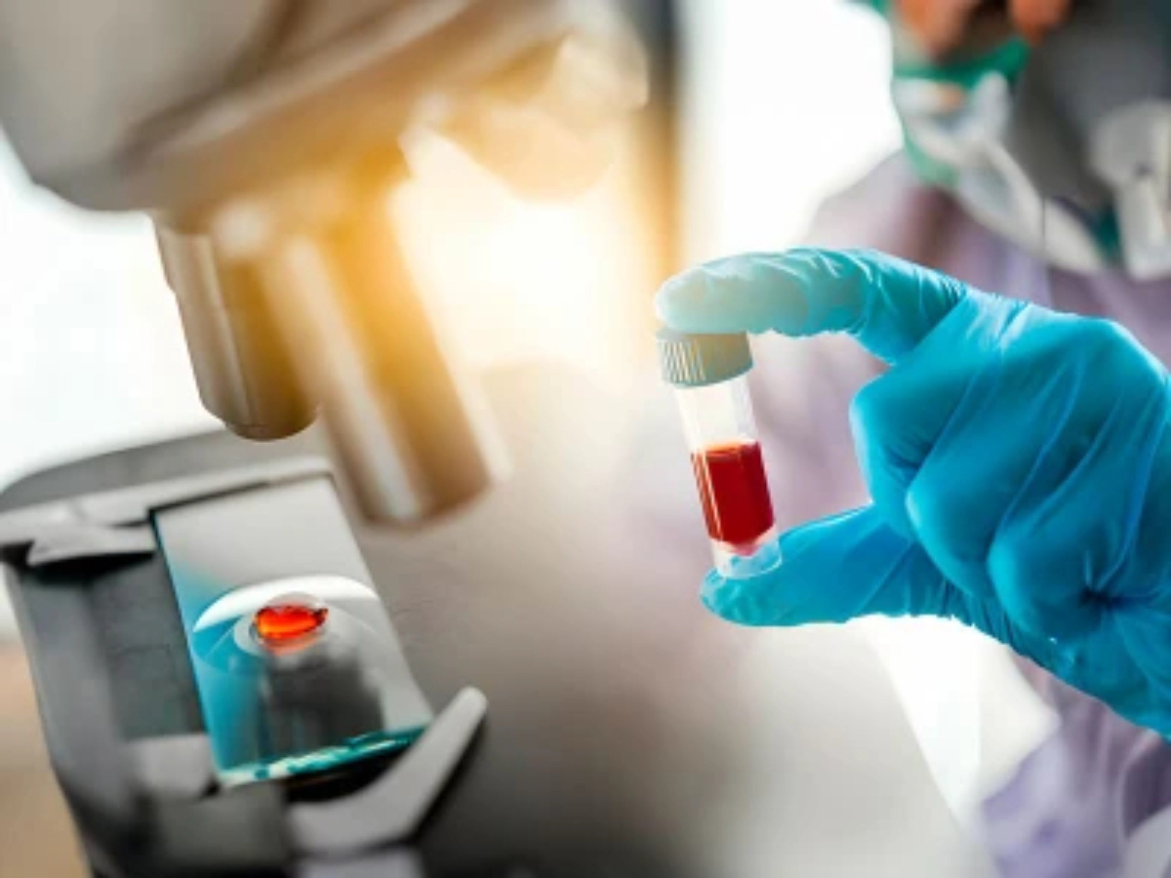 El Vínculo entre Enfermedades Psiquiátricas y el Riesgo de Trombosis