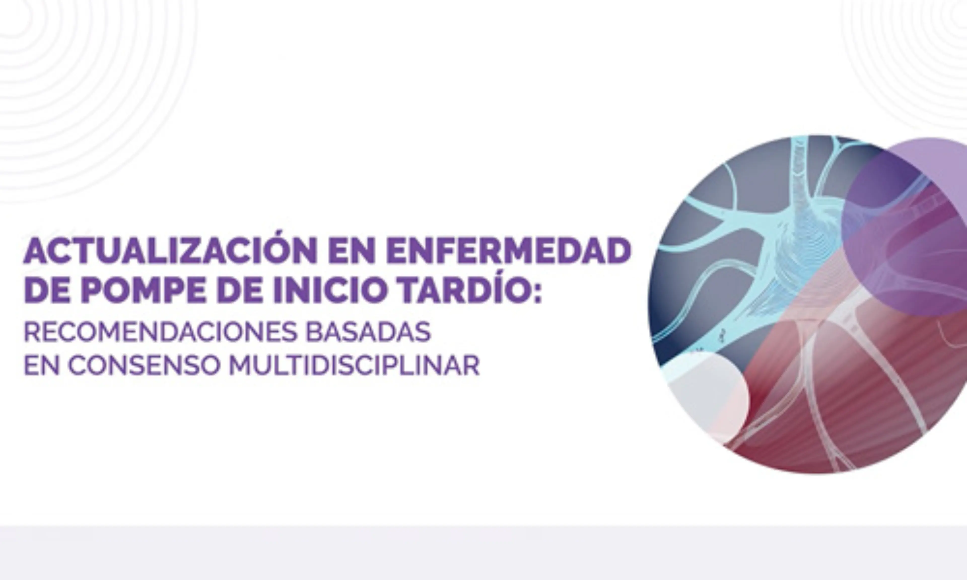 Recomendaciones prácticas basadas en consenso multidisciplinar para el diagnóstico, tratamiento y seguimiento de la enfermedad de Pompe de inicio tardío en la práctica clínica.