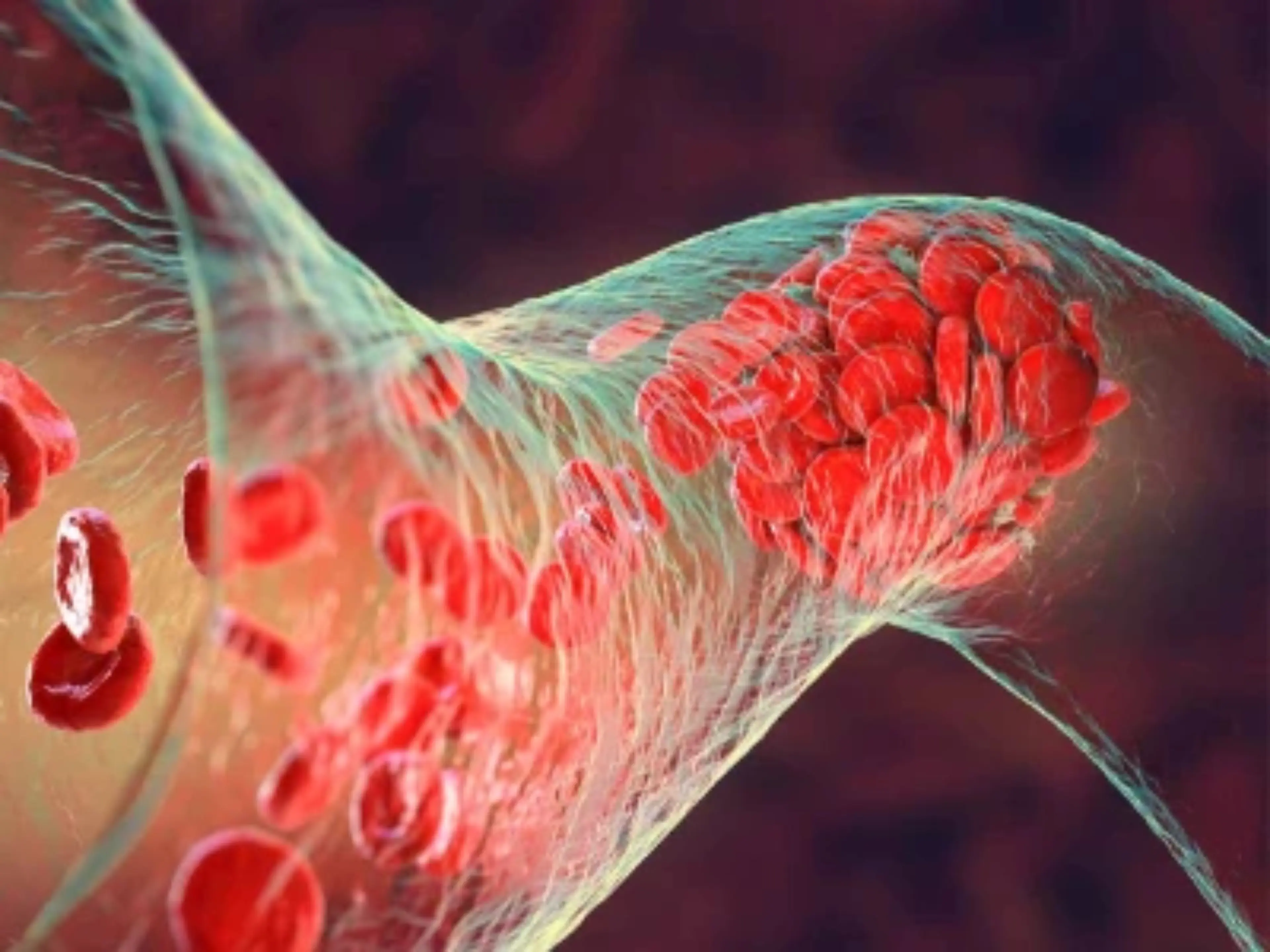 hipertension-arterial-curso-online