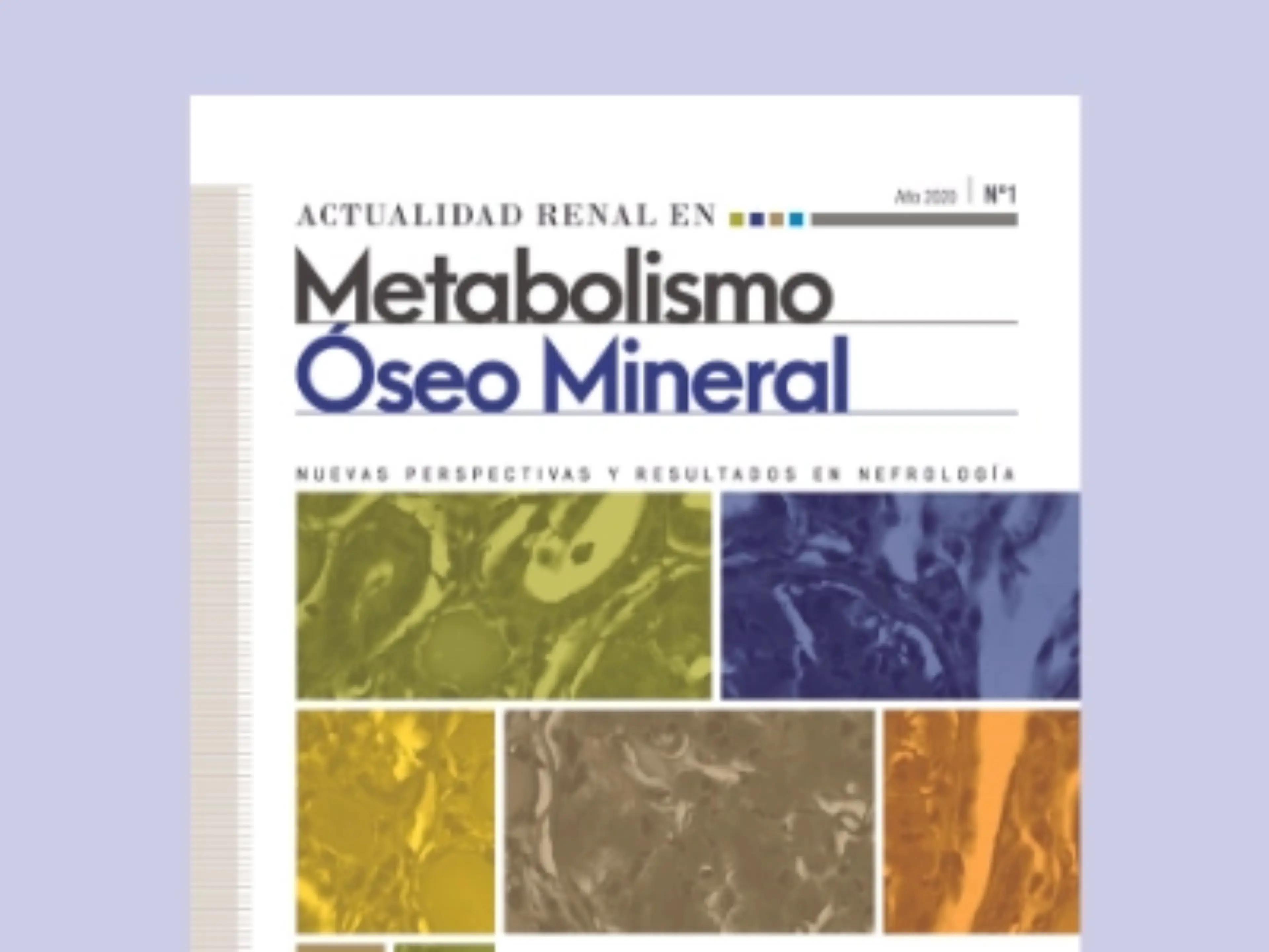 Fósforo, calcificación cardiovascular y supervivencia