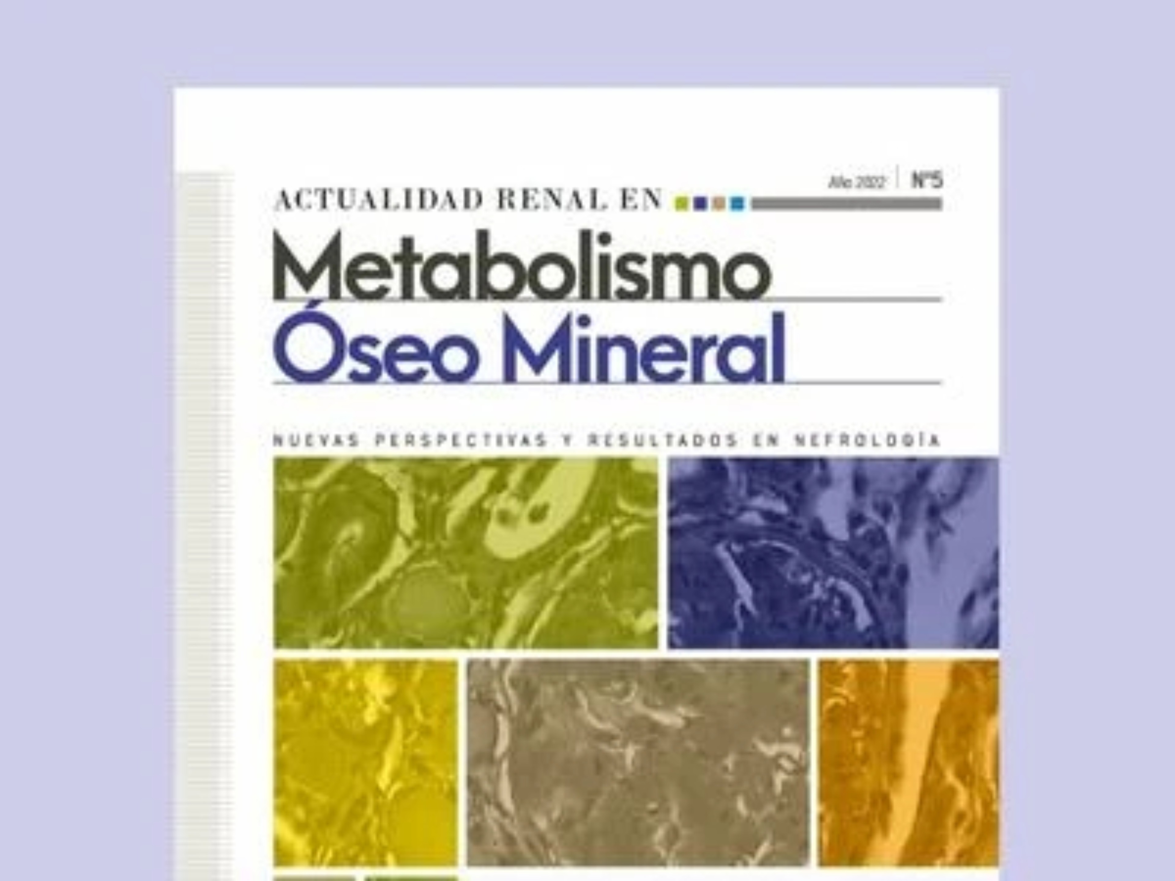 Actualidad renal en metabolismo óseo míneral Nº5 - Guías KDIGO 2021