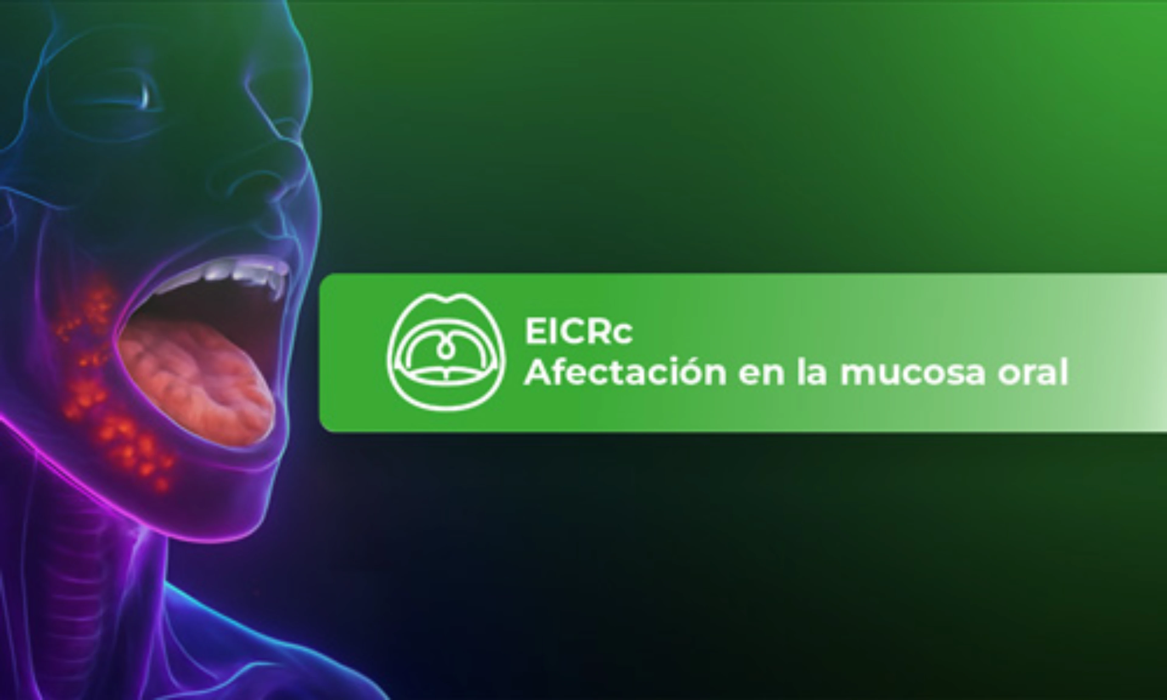 eicr-afectacion-mucosa-oral-card