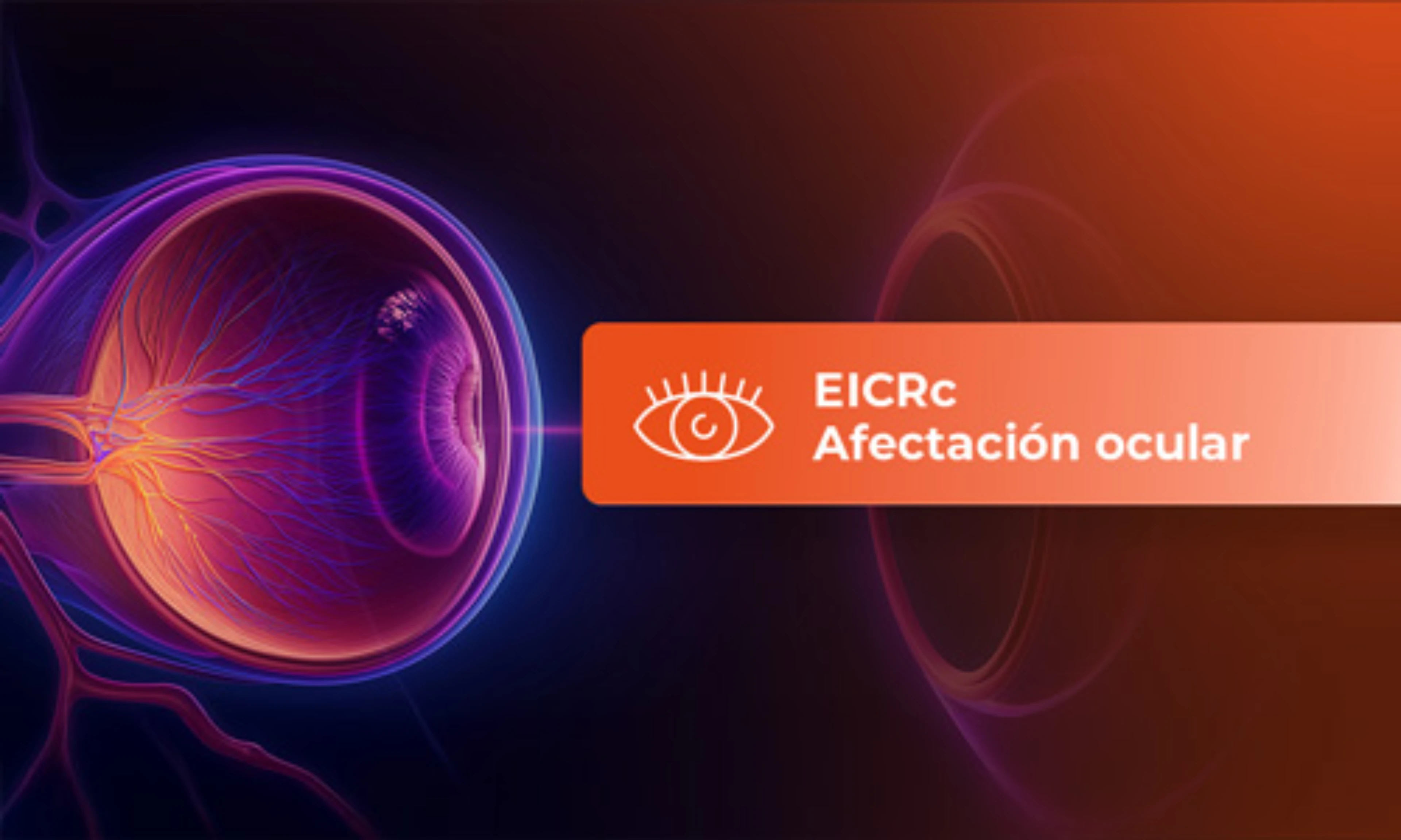 eicr-afectacion-ocular-card
