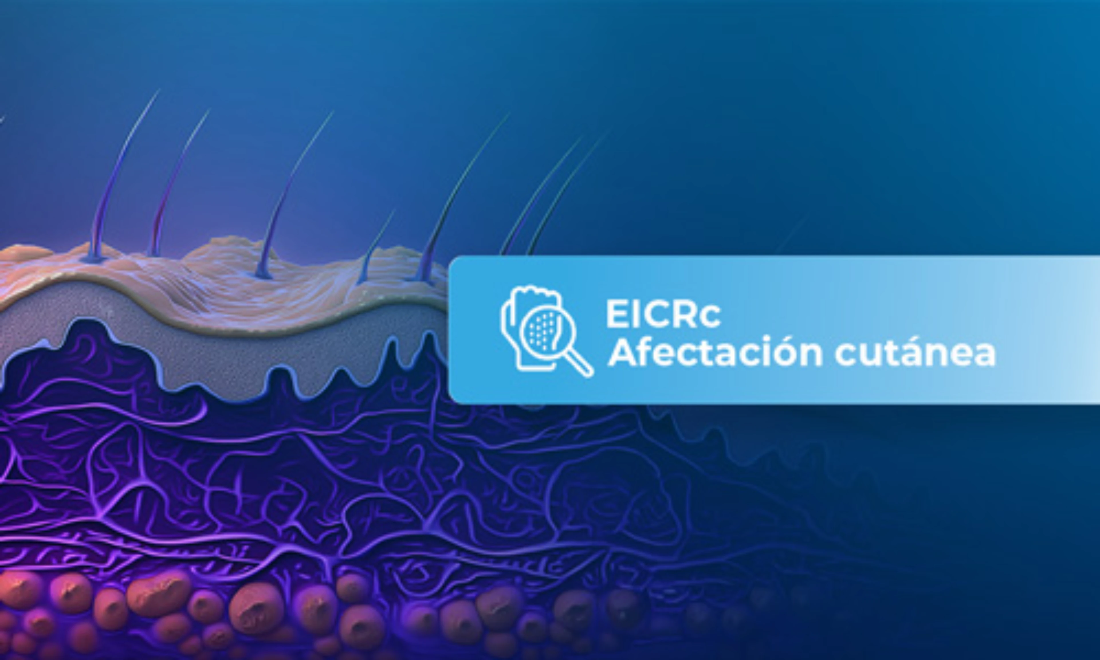 card-afectacion-cutanea