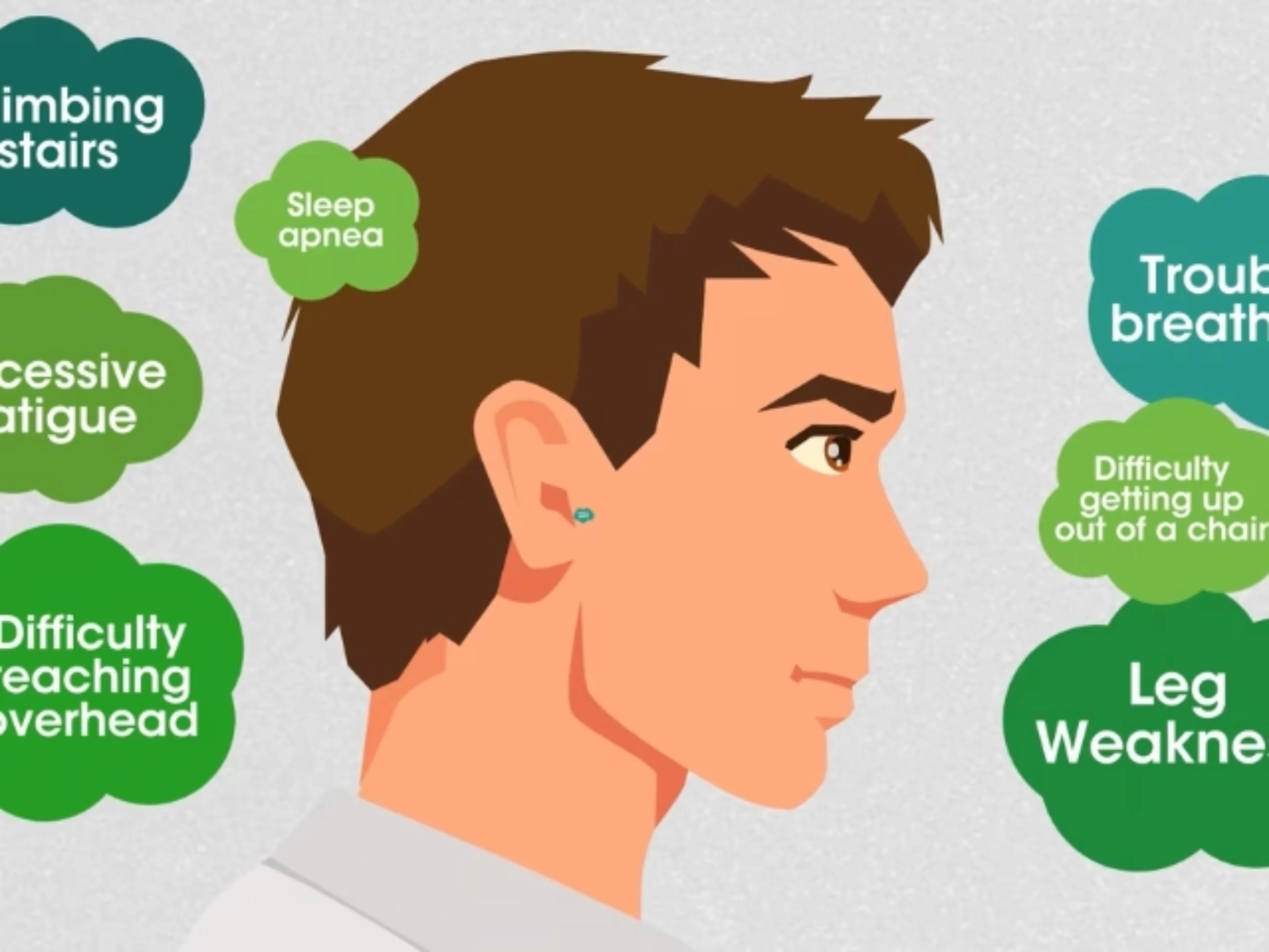 Navigating the Pompe Disease Journey