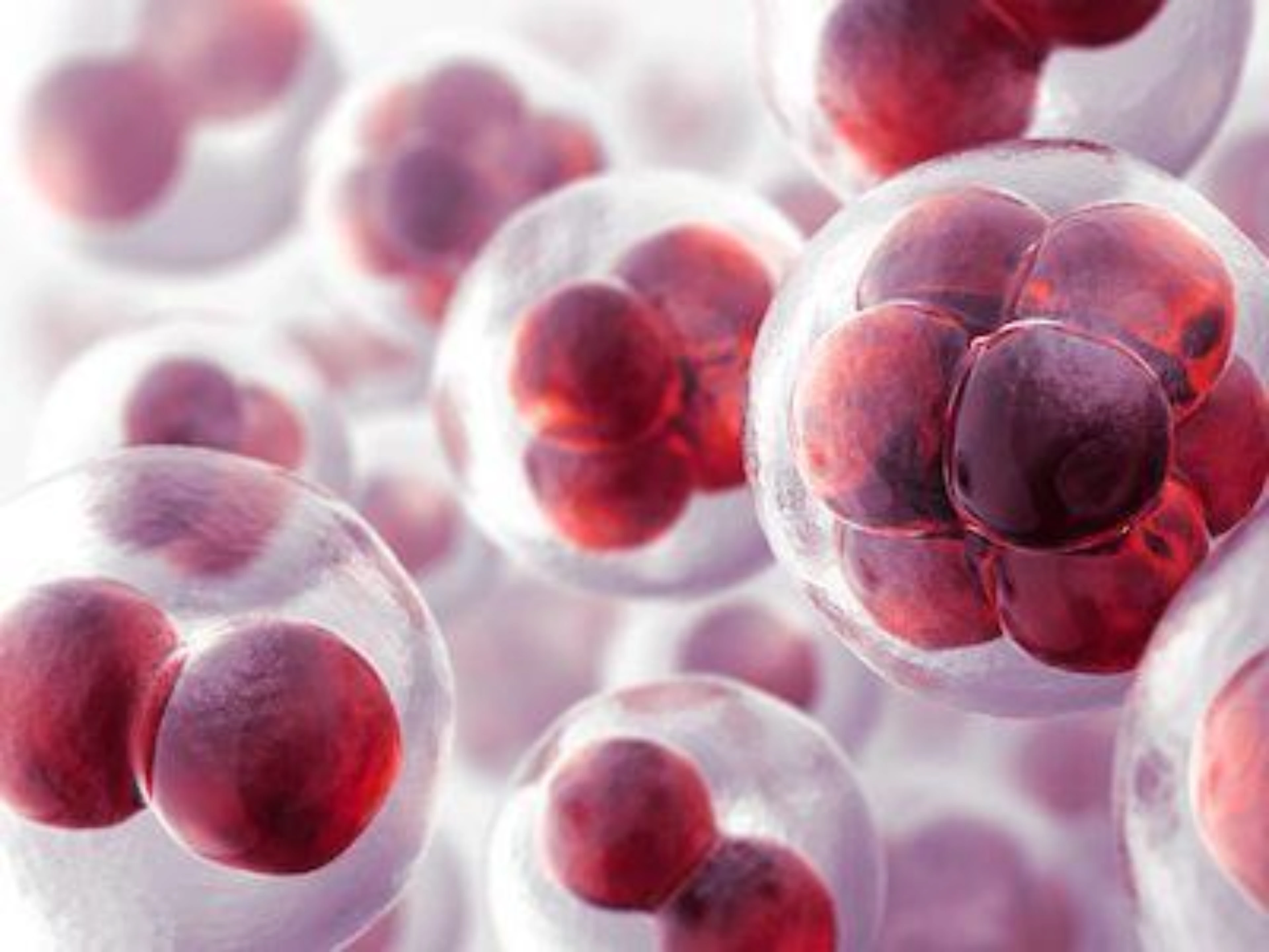 PCSK9 Inhibitors in Real World Practice