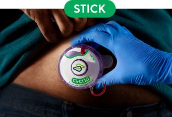 Action shot of attaching CirCLIQ to abdomen.