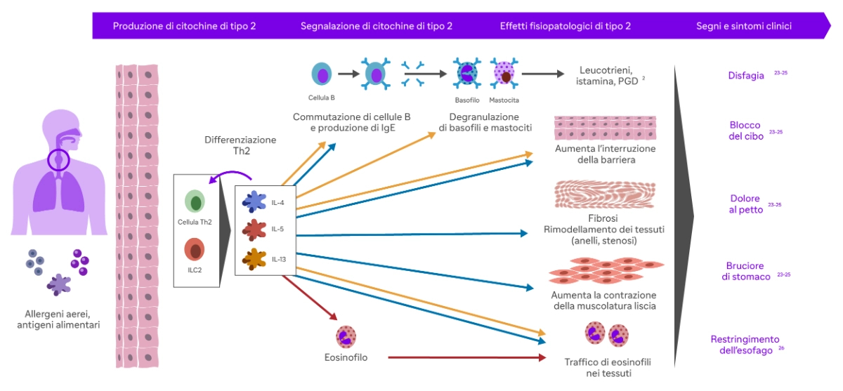 Sanofi_EoE-02