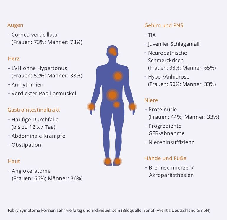 Infografik zeigt menschliche Silhouette mit orangefarbenen Markierungen an Augen, Herz, Magen-Darm-Trakt, Haut, Gehirn, Niere sowie Händen und Füßen, dazu Symptome von Morbus Fabry.