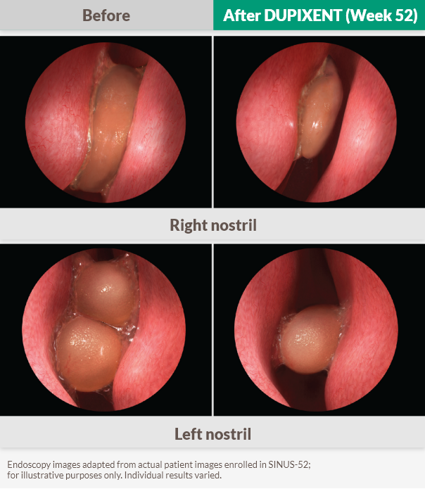Endoscopy