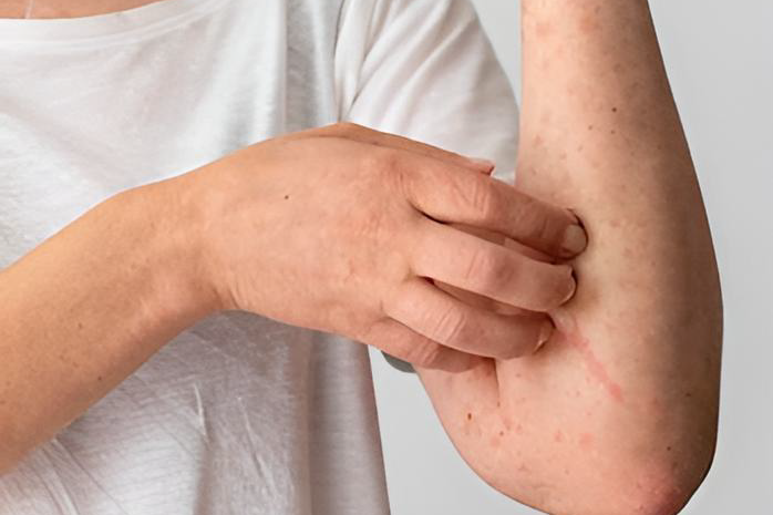 skin-itch